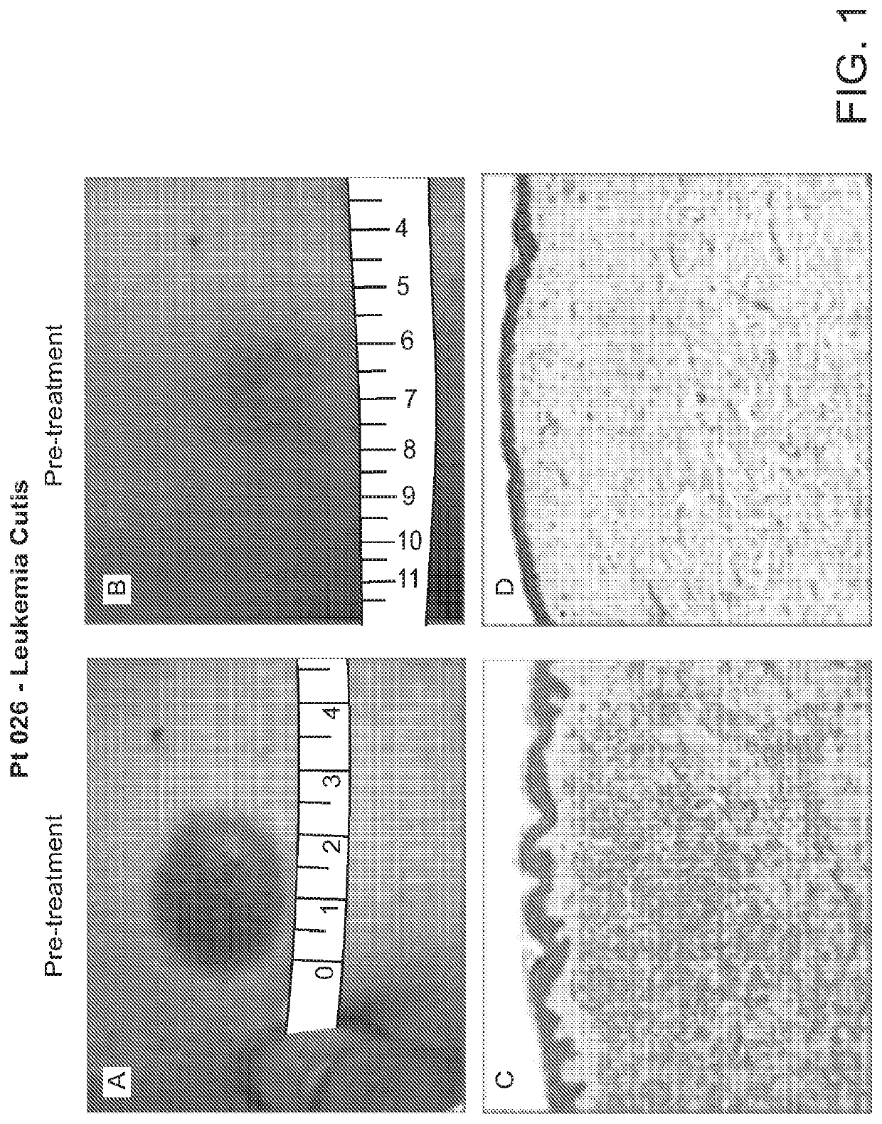 Compositions and methods for identifying and treating resistance to ctla4 antagonists in leukemia