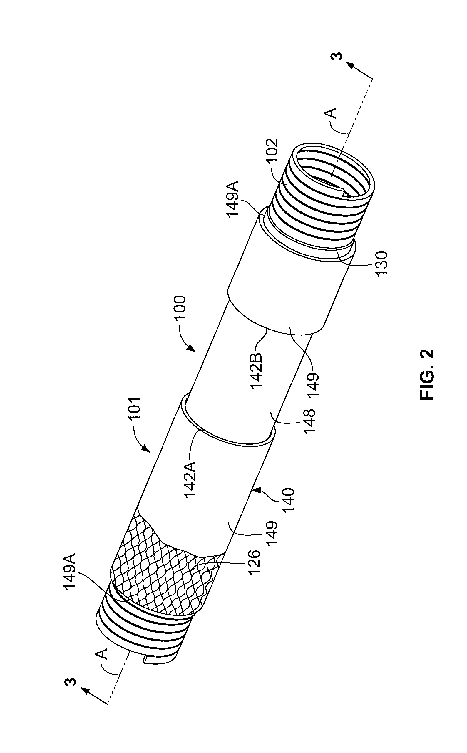 Methods and systems for forming a protected disconnectable joint assembly