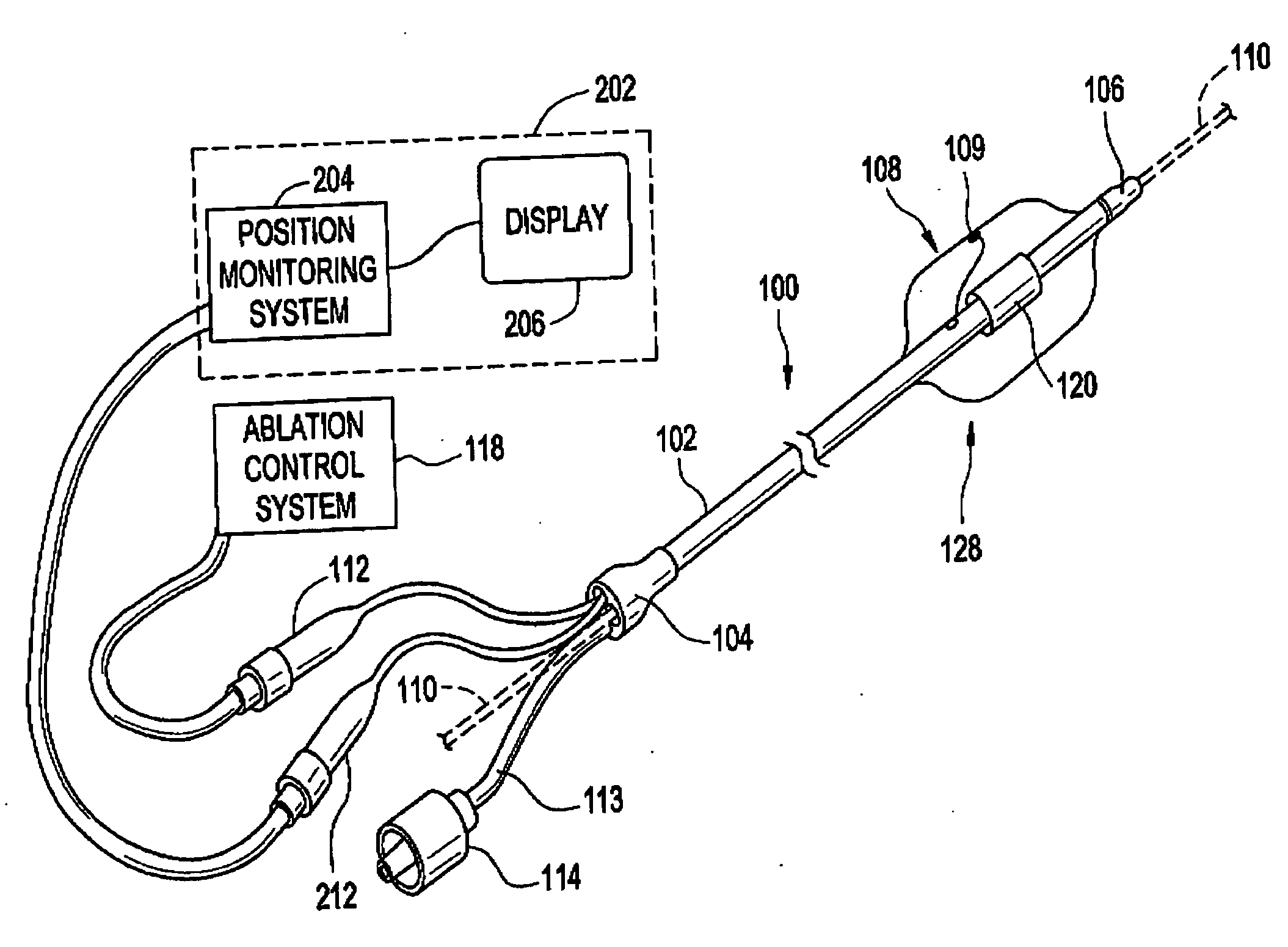 Ablation device with phased array ultrasound transducer