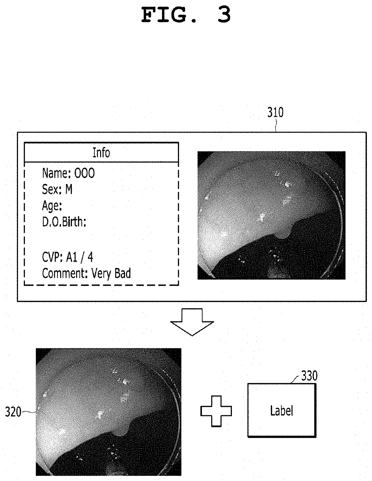 Artificial intelligence-based colonoscopic image diagnosis assisting system and method