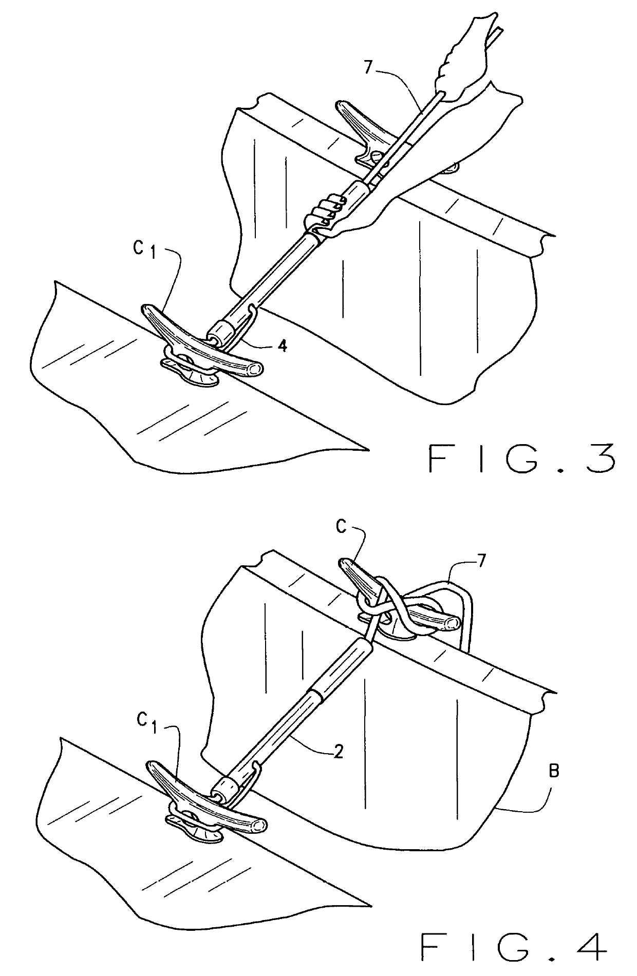 Boat Tie Down Apparatus