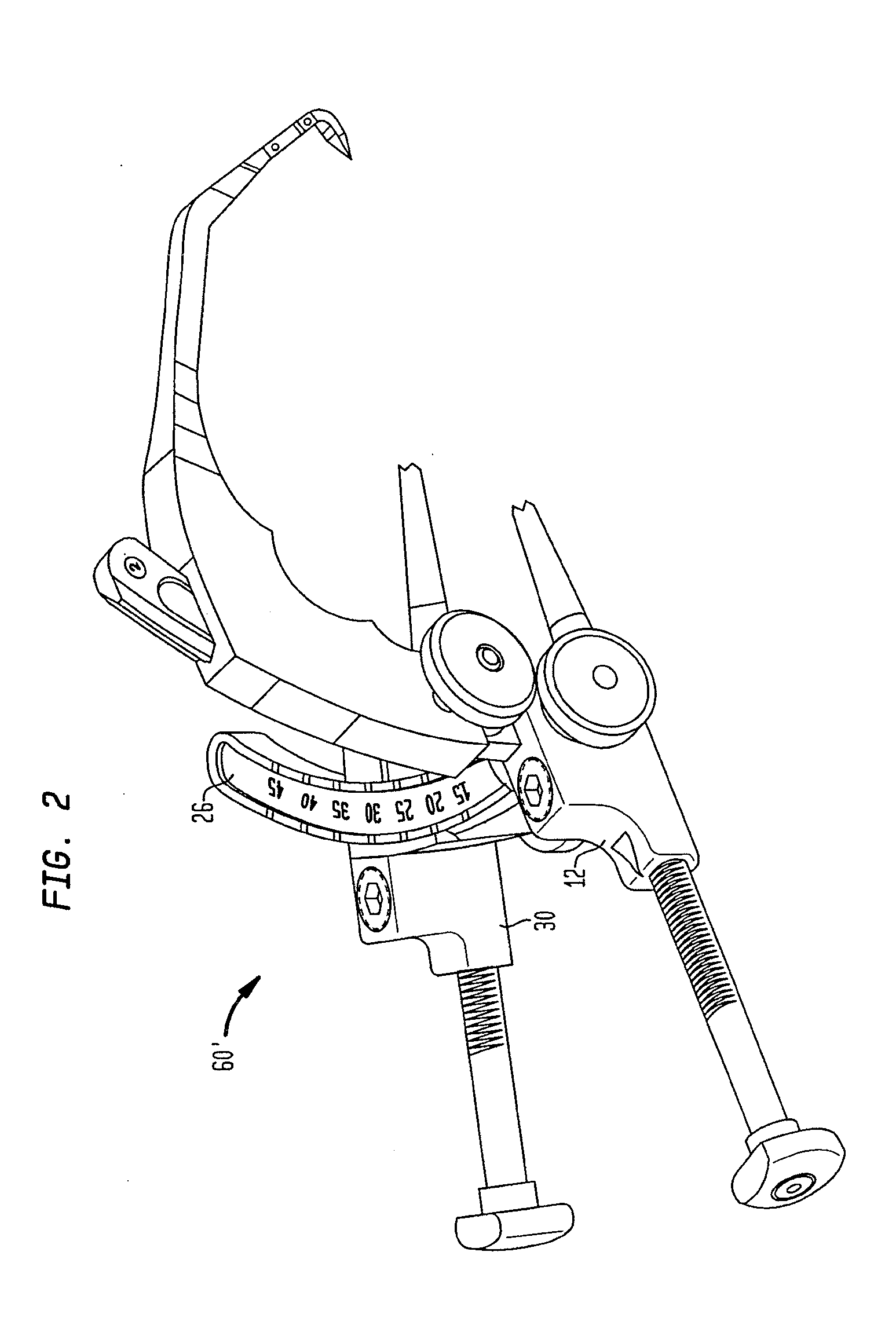 Methods and devices for ligament repair