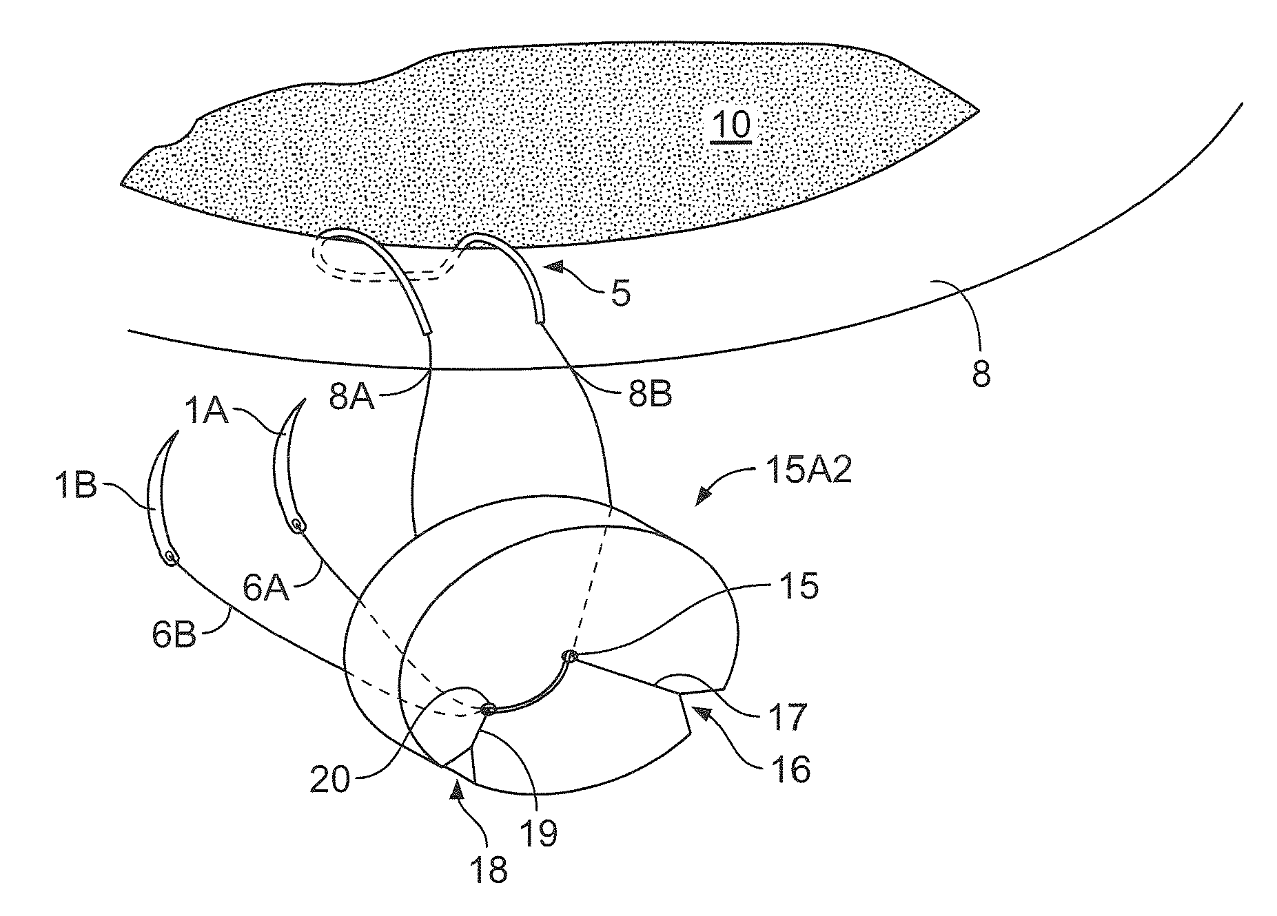 Apparatus and method for performing ocular surgery