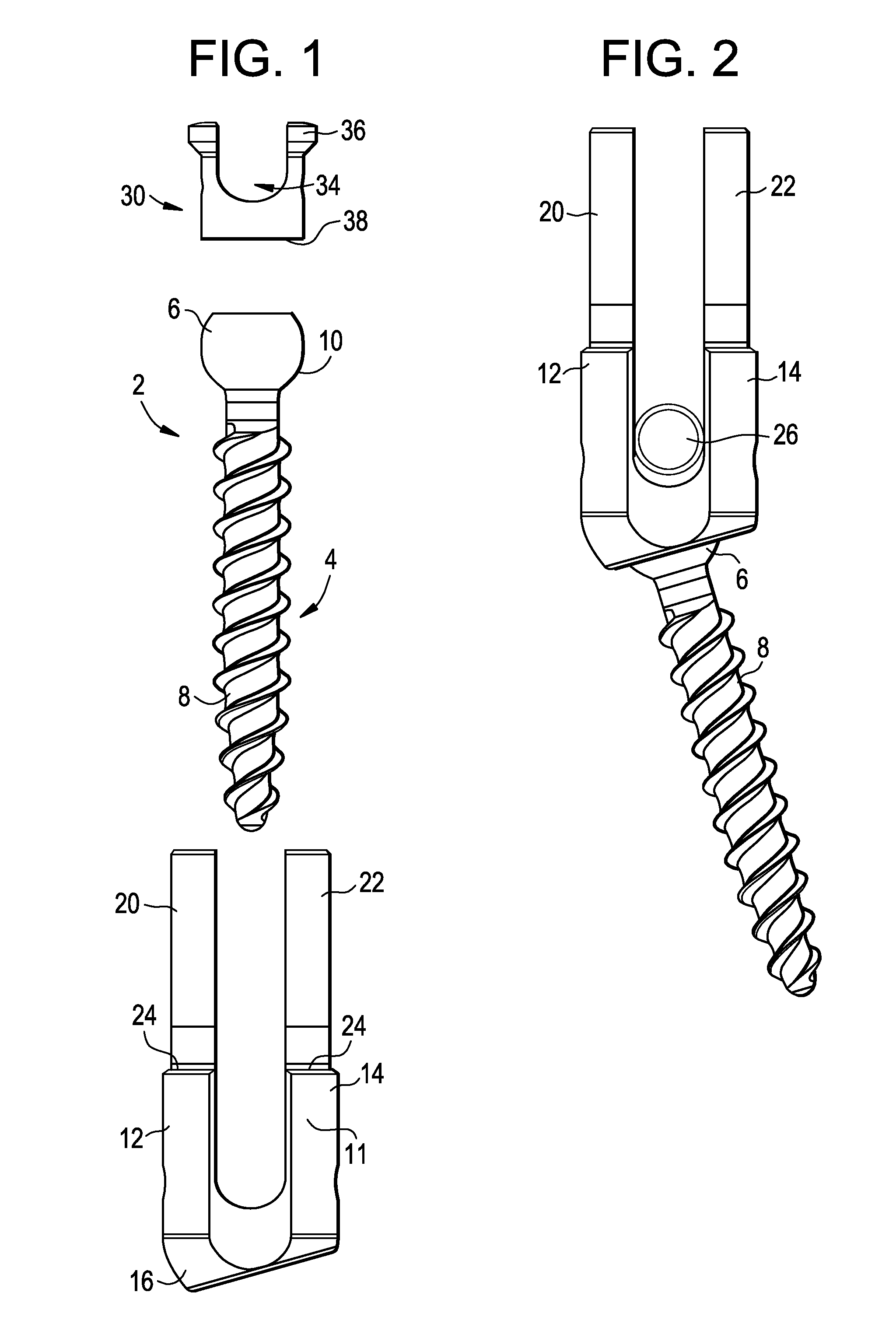 Methods for correction of spinal deformities