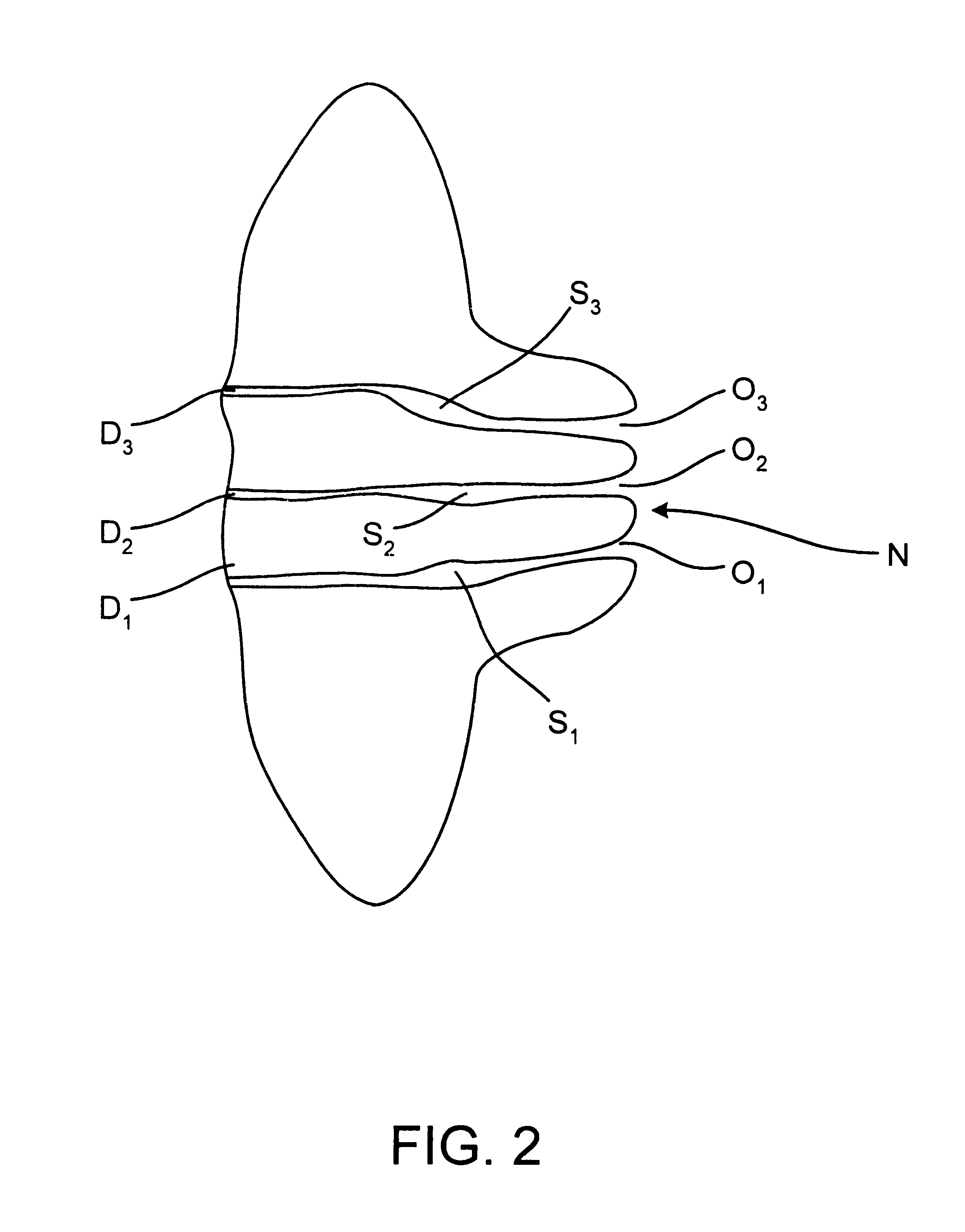 Methods and kits for identifying ductal orifices in a nipple