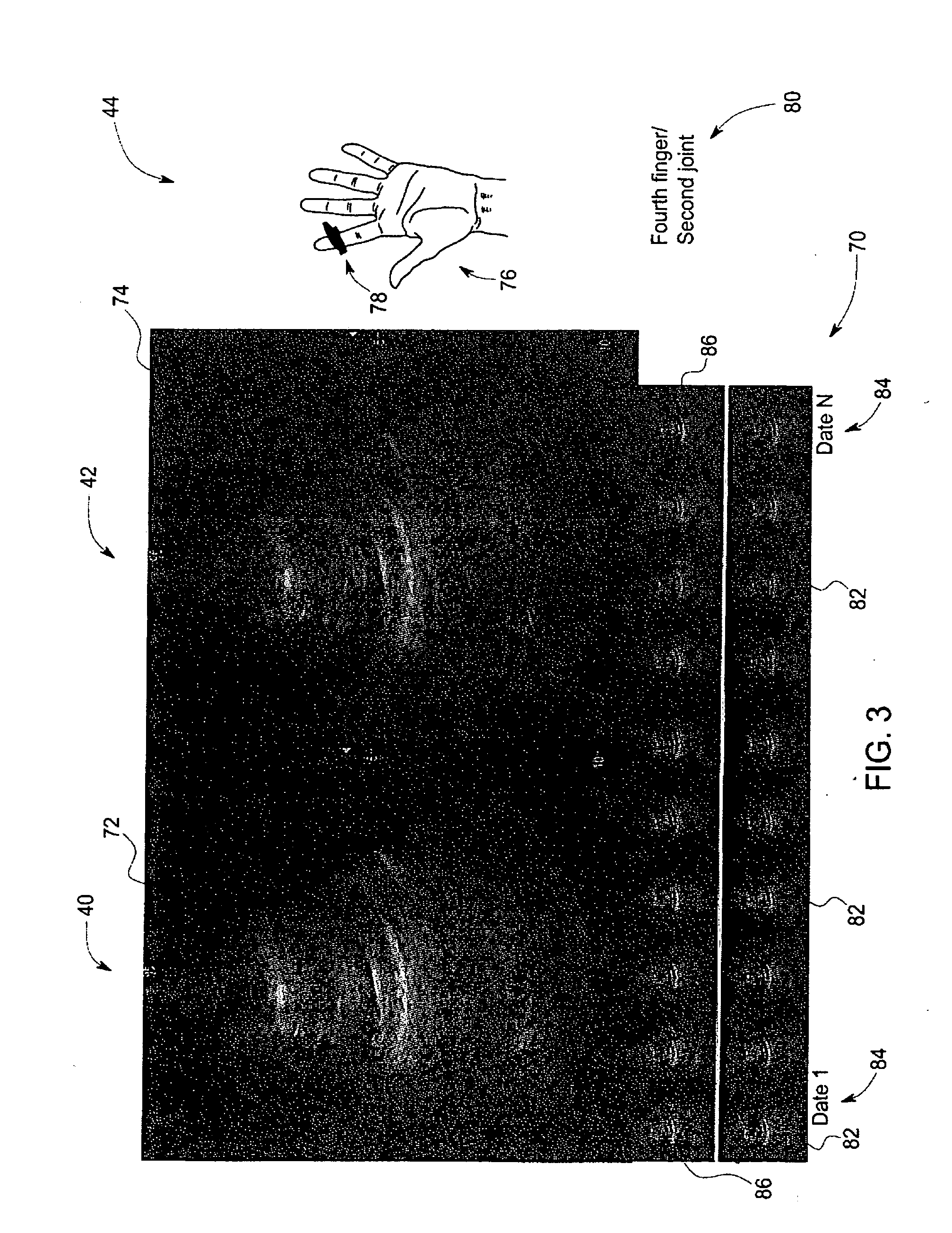 Method and system for organizing stored ultrasound data