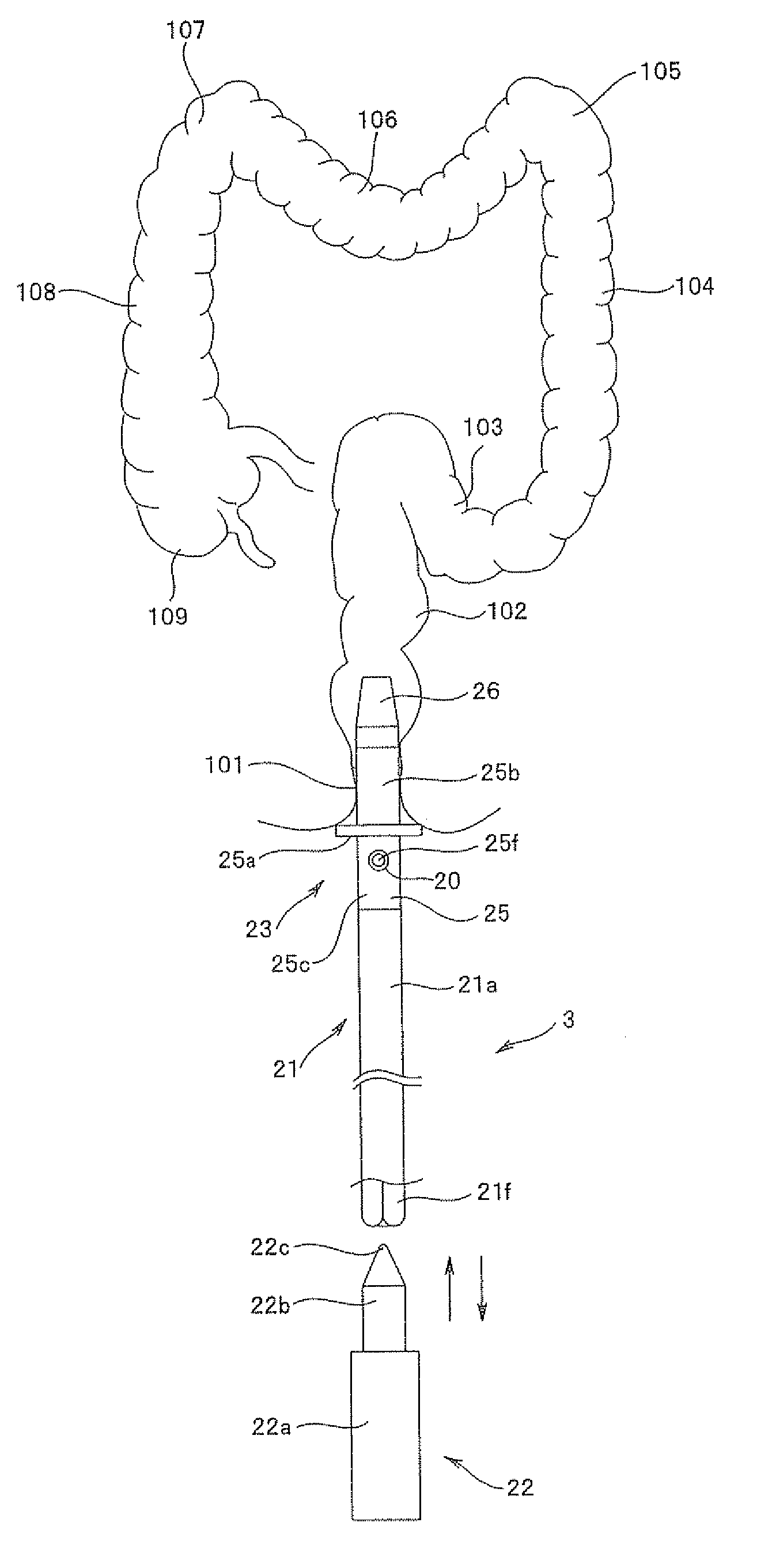 Medical Instrument Insertion Guide System