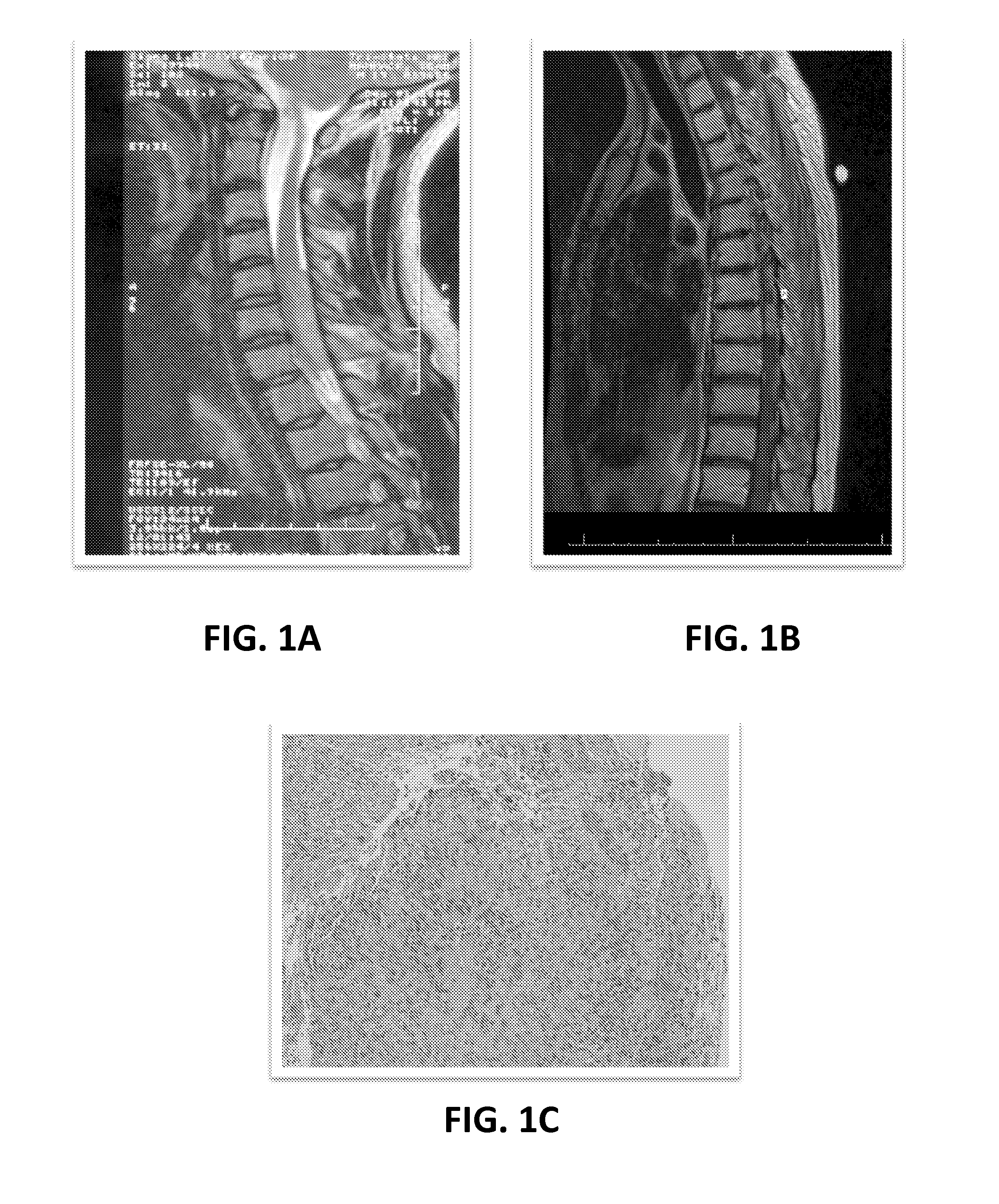 Methods of screening chemotherapeutic agents and treating cancer