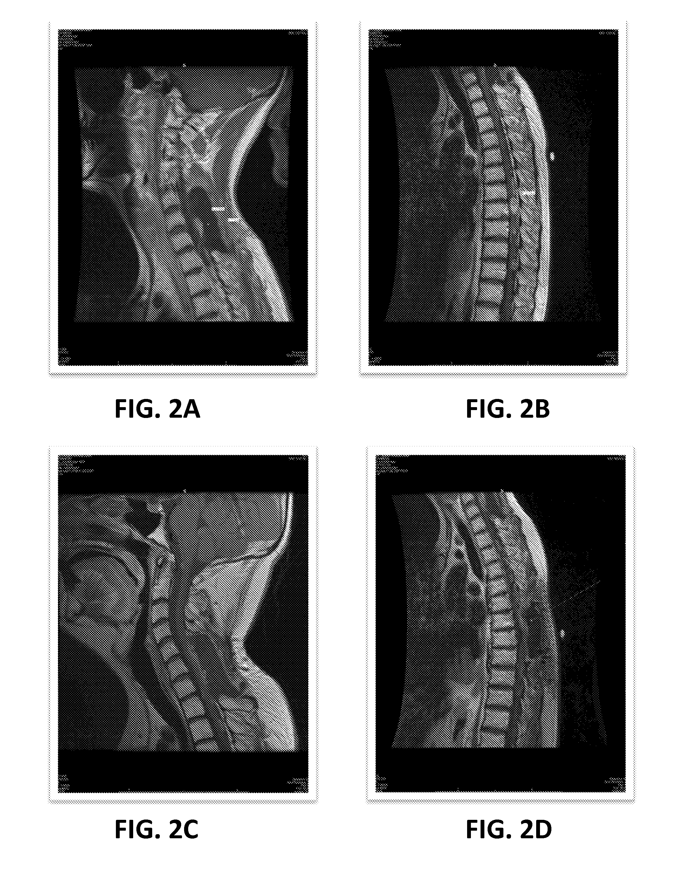 Methods of screening chemotherapeutic agents and treating cancer