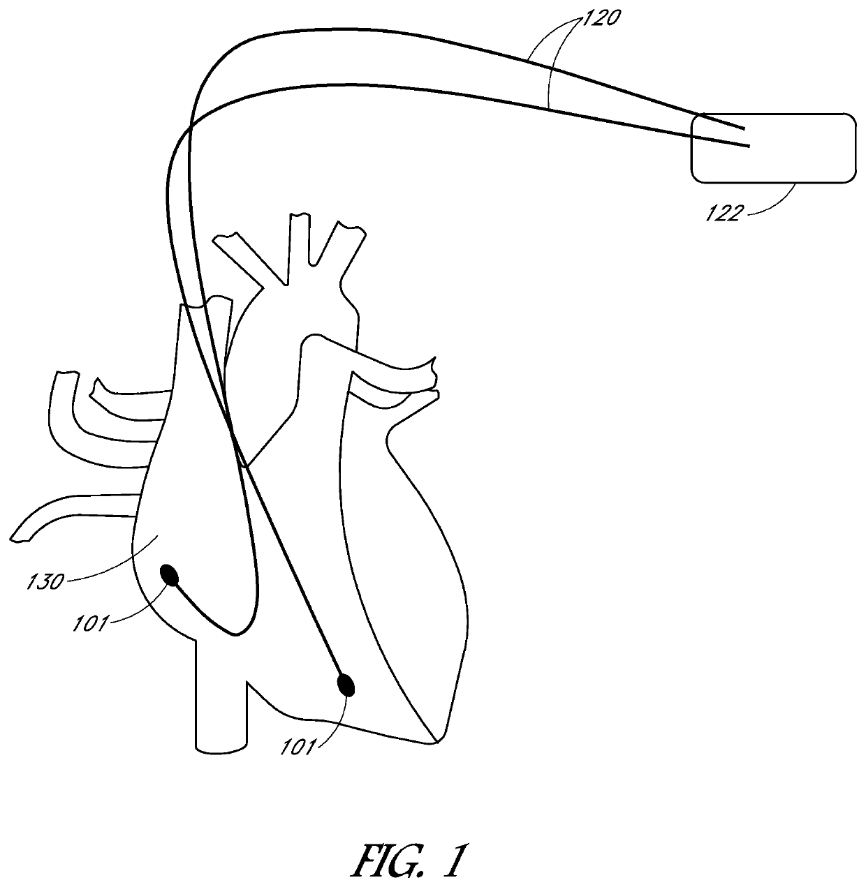 Non-fibrotic biocompatible electrode and related methods