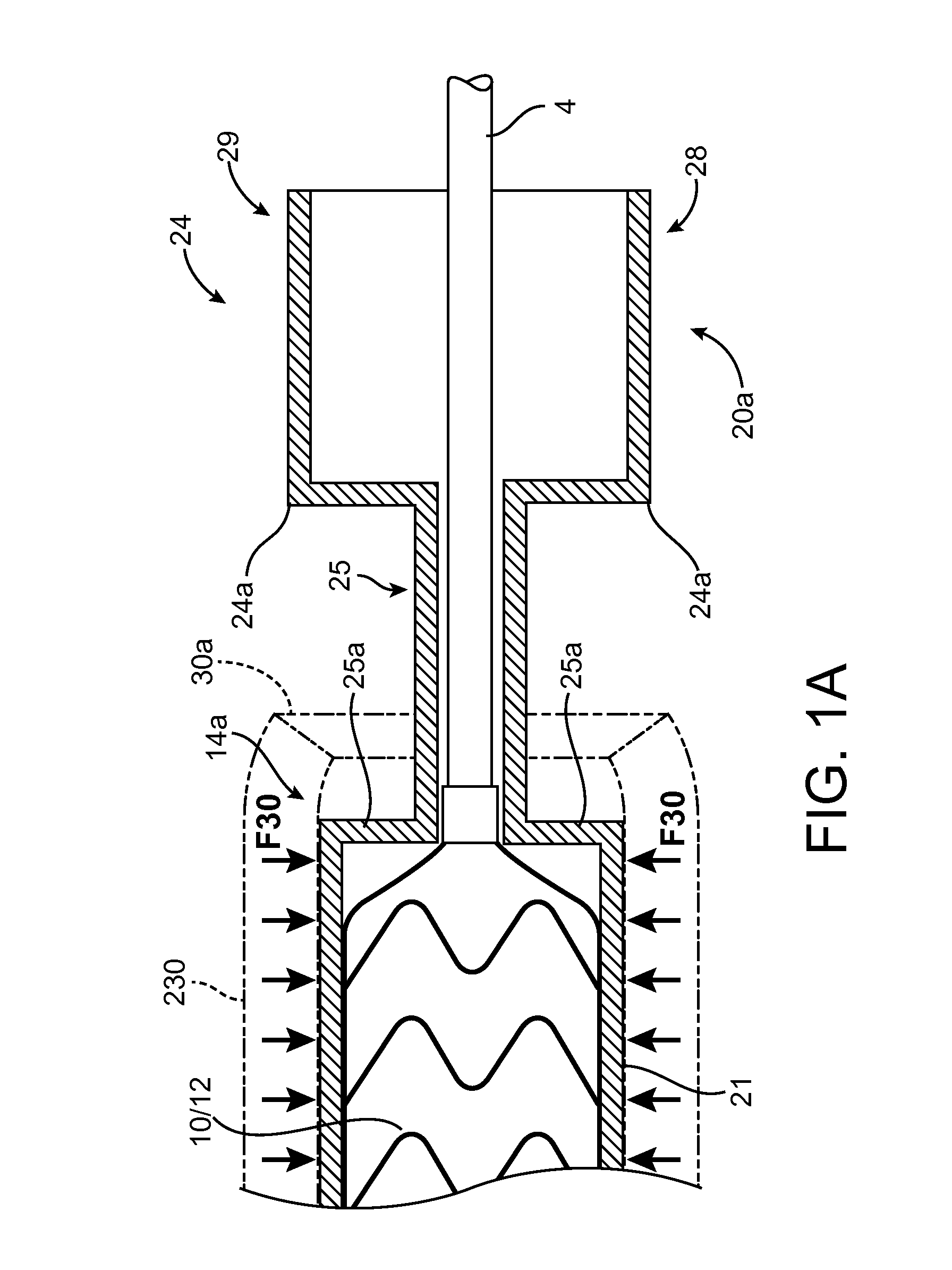 Removable sheath assembly for a polymer scaffold