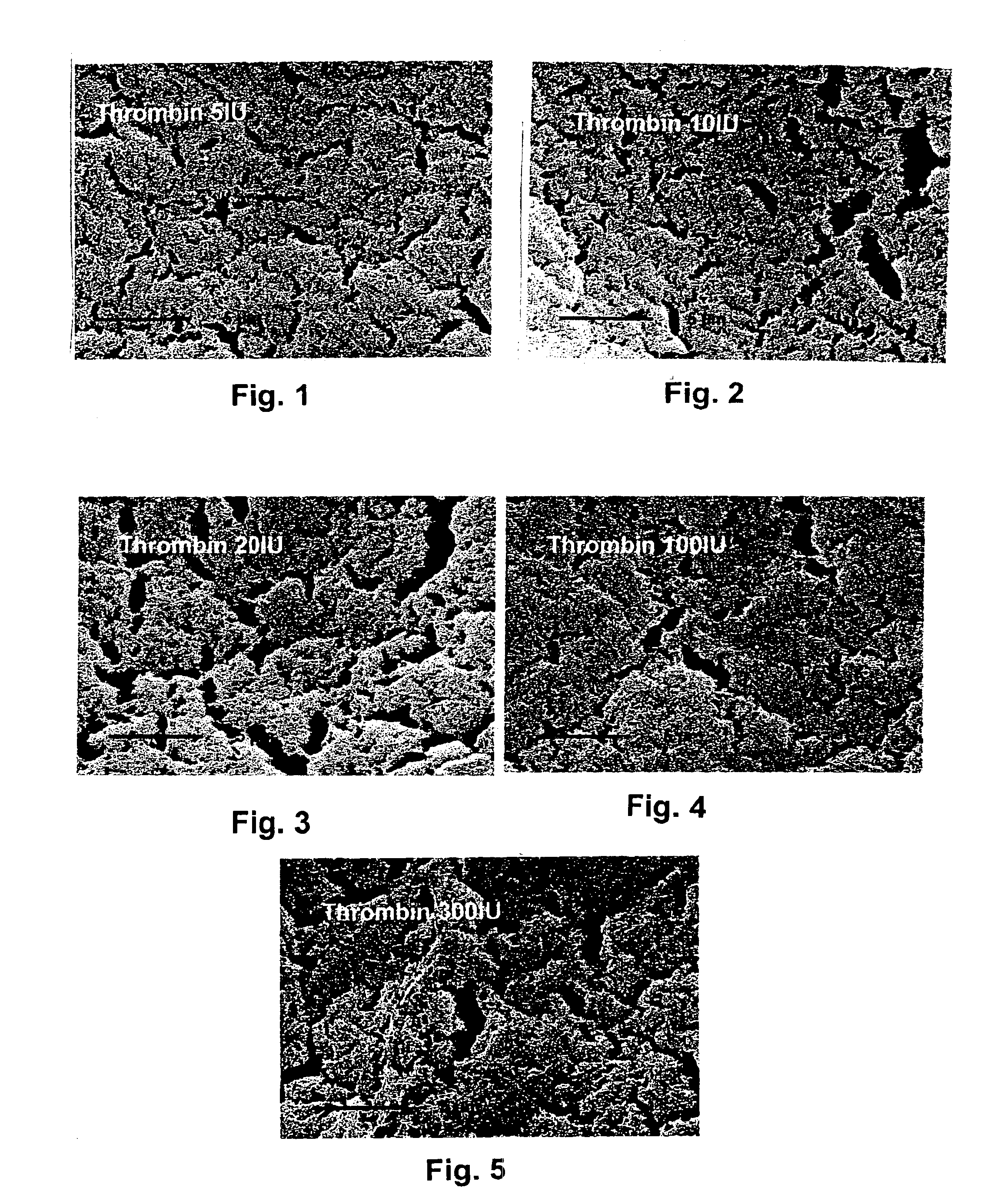 Fibrin material and method for producing and using the same