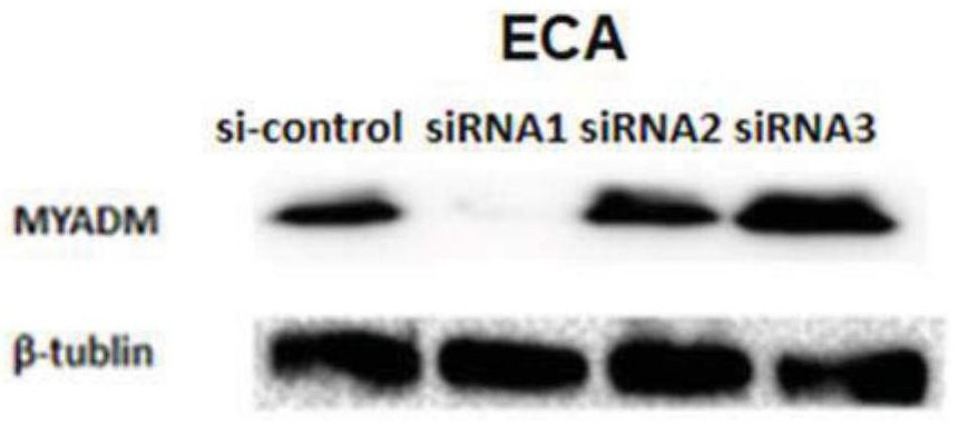 myadm-targeted siRNAs and their applications