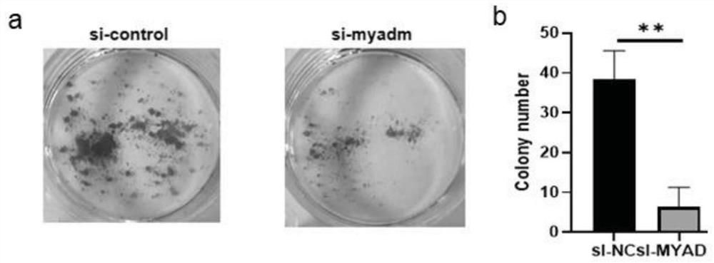 myadm-targeted siRNAs and their applications