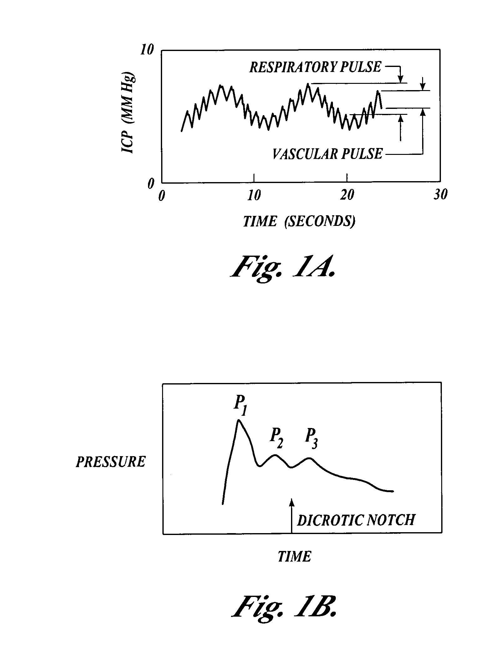Systems and methods for making non-invasive physiological assessments by detecting induced acoustic emissions