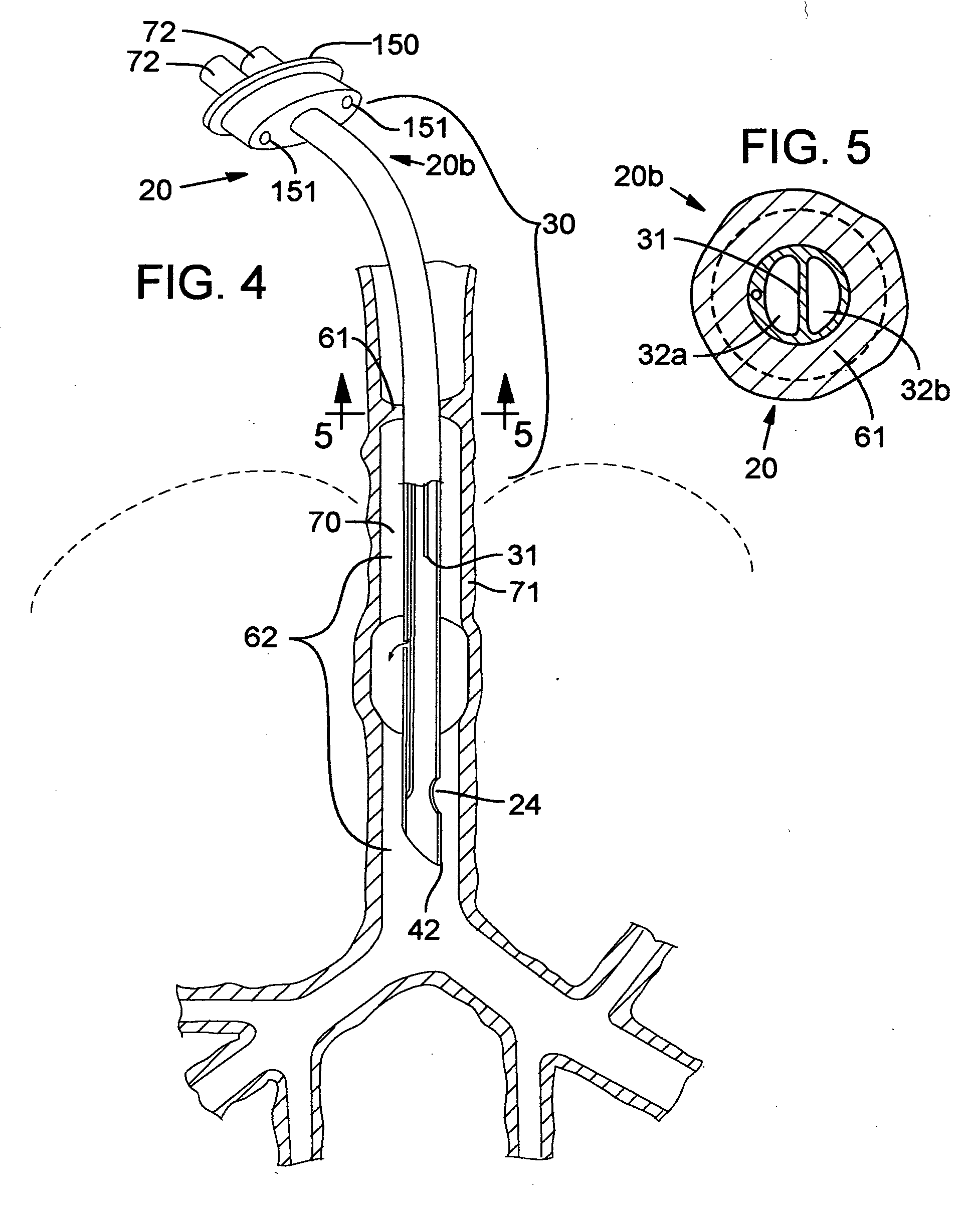 Secretion clearing ventilation catheter and airway management system