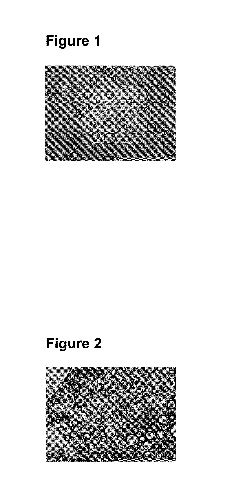 Foamable Compositions and Kits Comprising One or More of a Channel Agent, a Cholinergic Agent, A nitric Oxide Donor and Related Agents and Their Uses