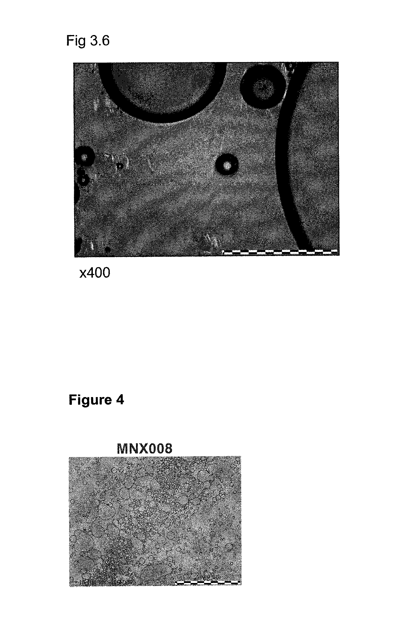 Foamable Compositions and Kits Comprising One or More of a Channel Agent, a Cholinergic Agent, A nitric Oxide Donor and Related Agents and Their Uses