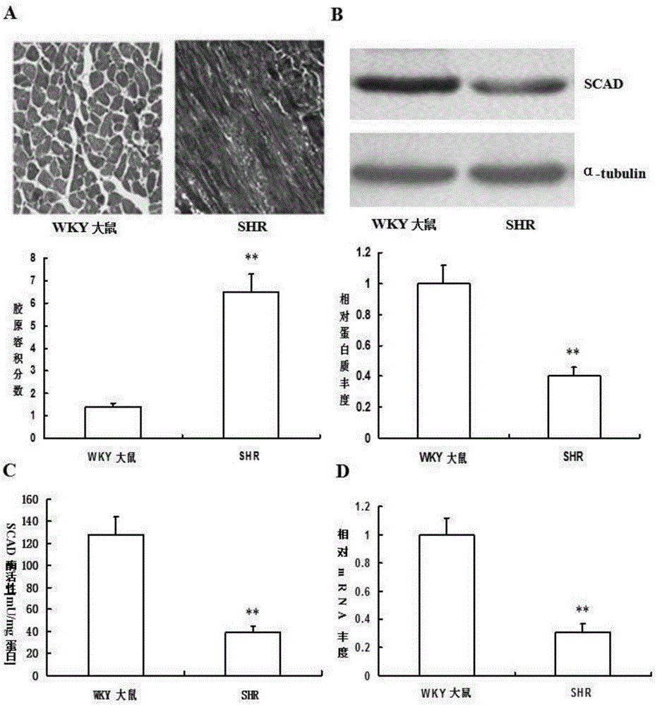 Application of SCAD gene or SCAD protein