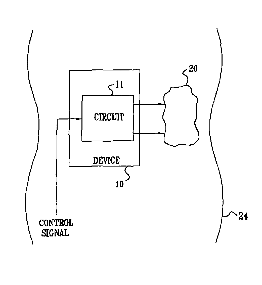 Efficient dynamic stimulation in an implanted device