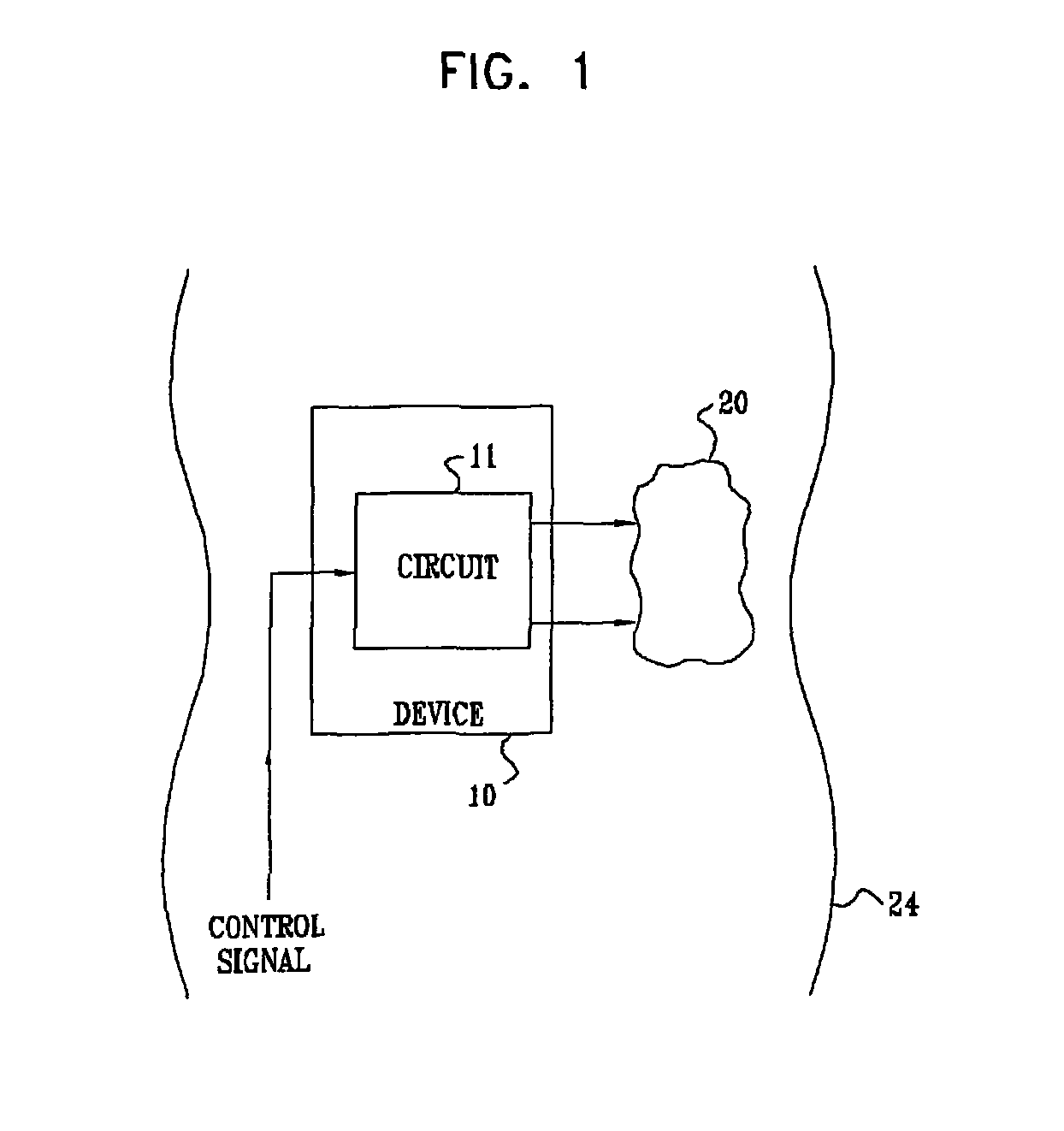 Efficient dynamic stimulation in an implanted device