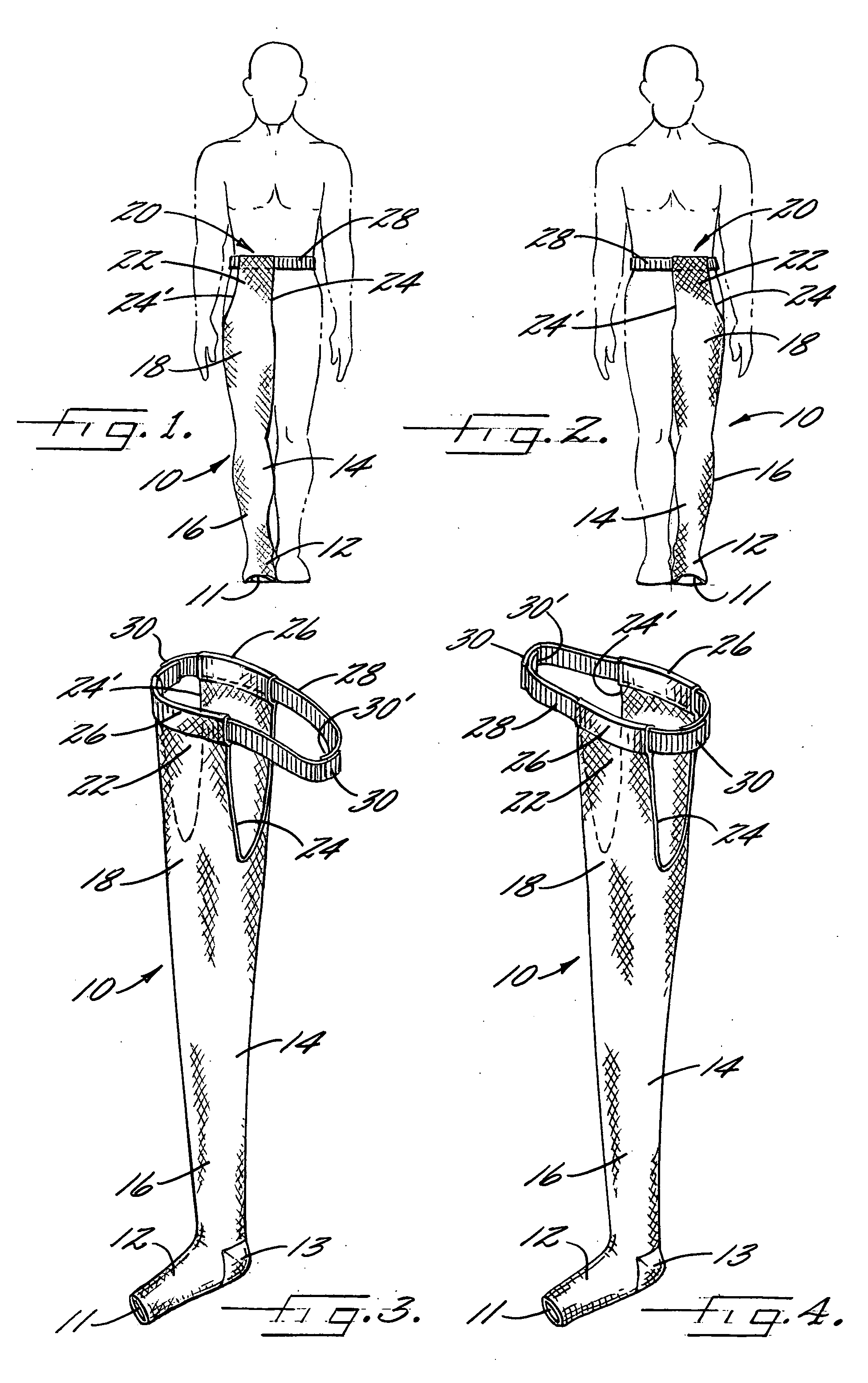 Universal chap-style compression stocking