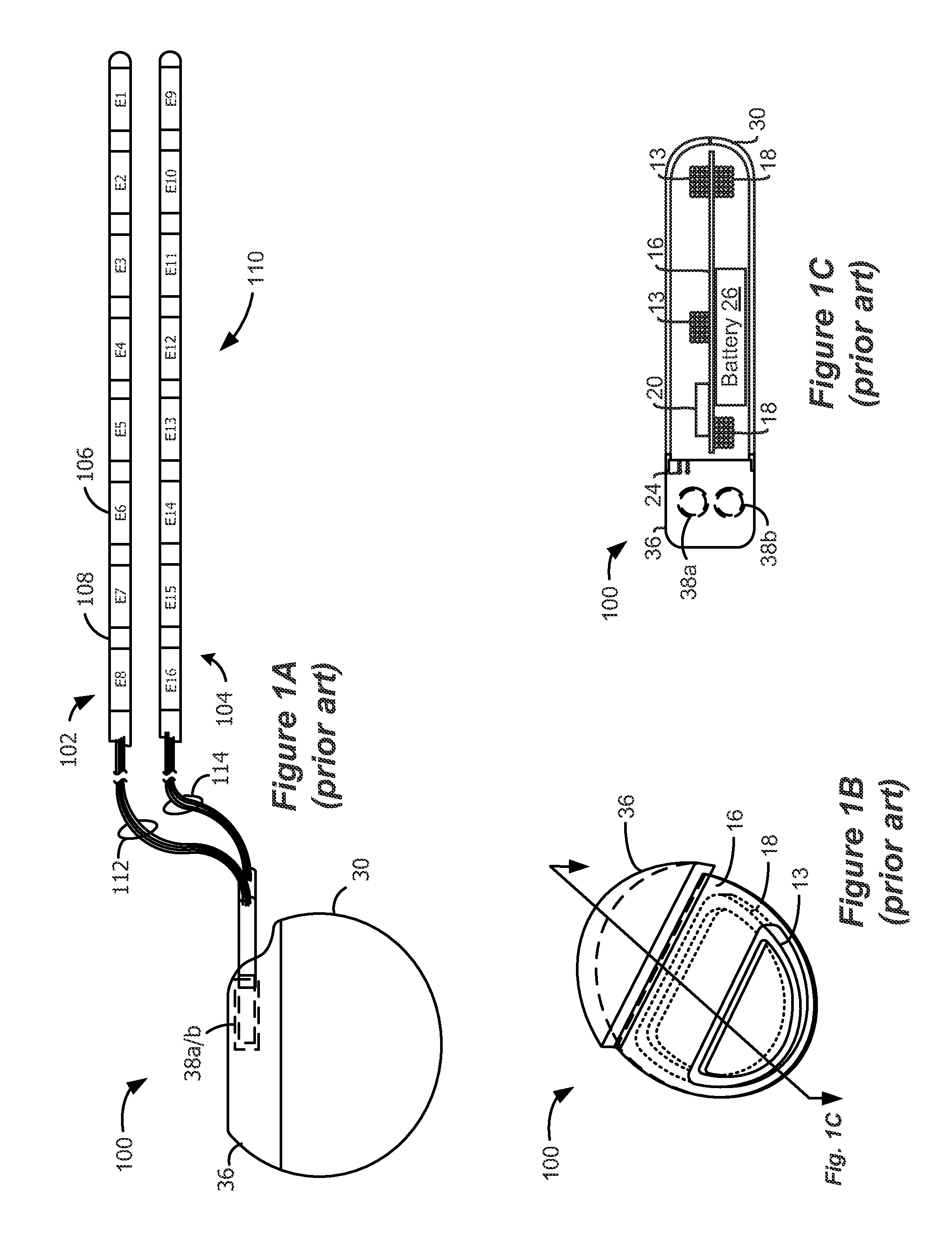 Charger Alignment in an Implantable Medical Device System Employing Reflected Impedance Modulation