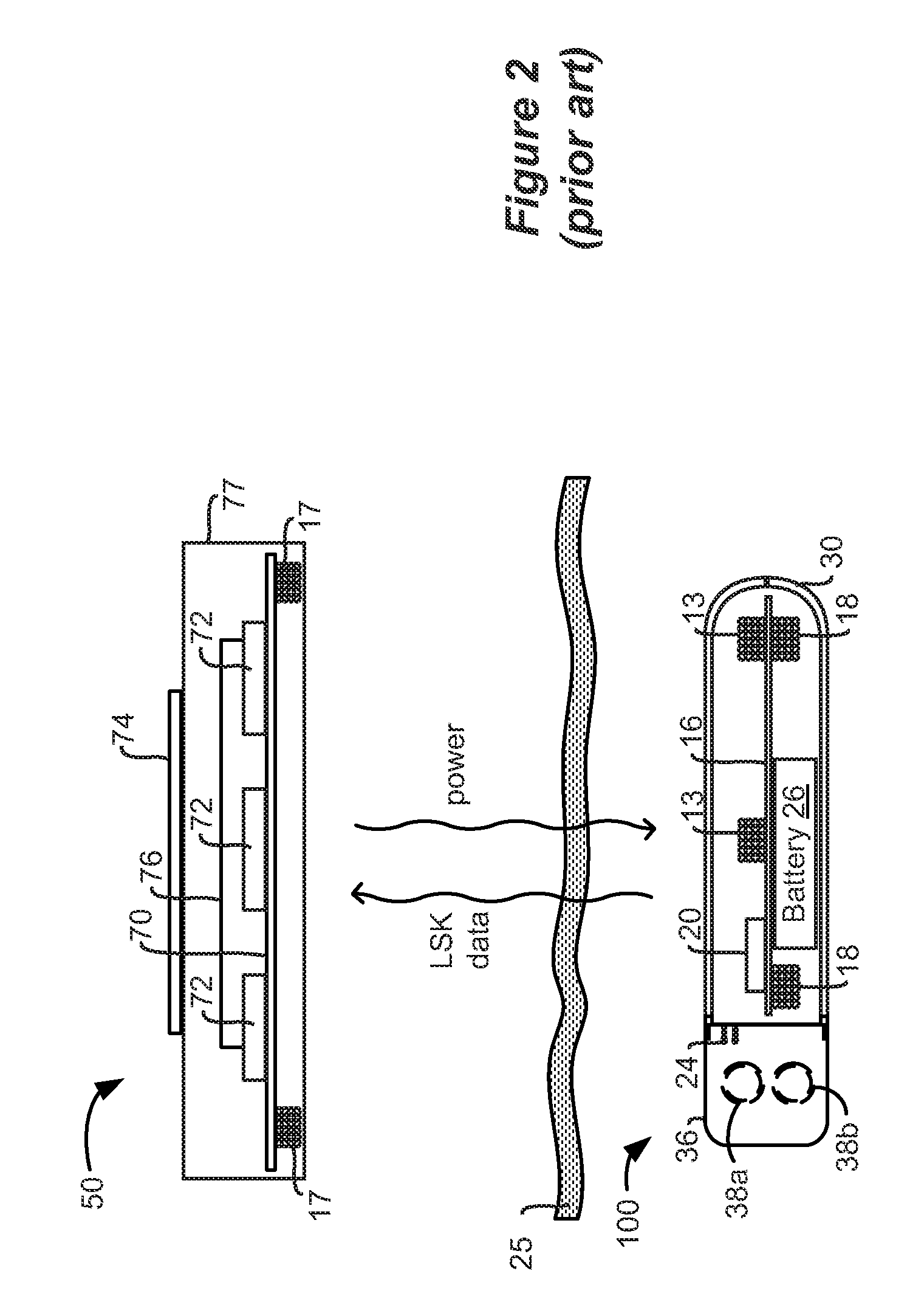 Charger Alignment in an Implantable Medical Device System Employing Reflected Impedance Modulation