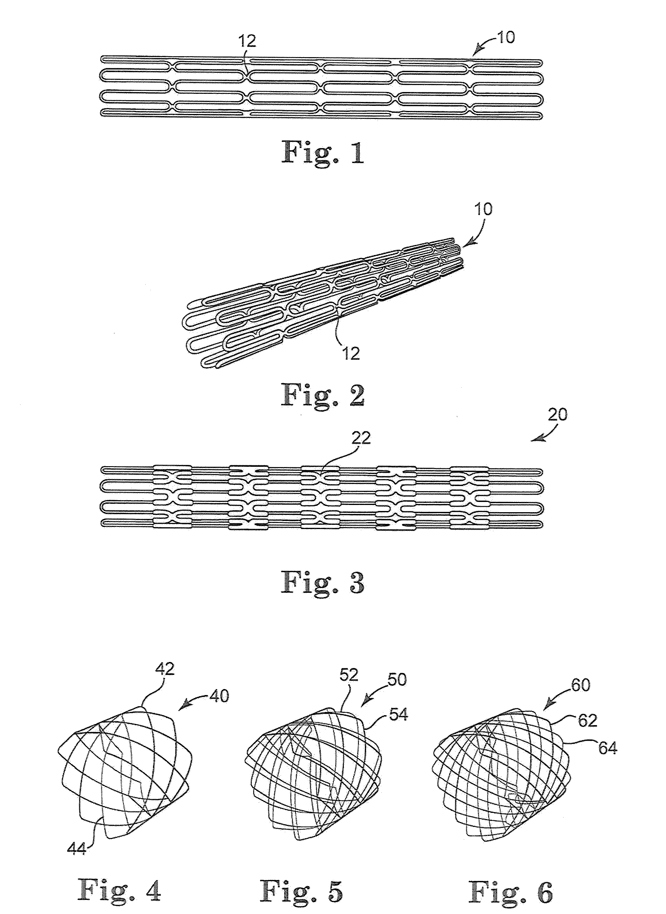 Multi-layered stents and methods of implanting