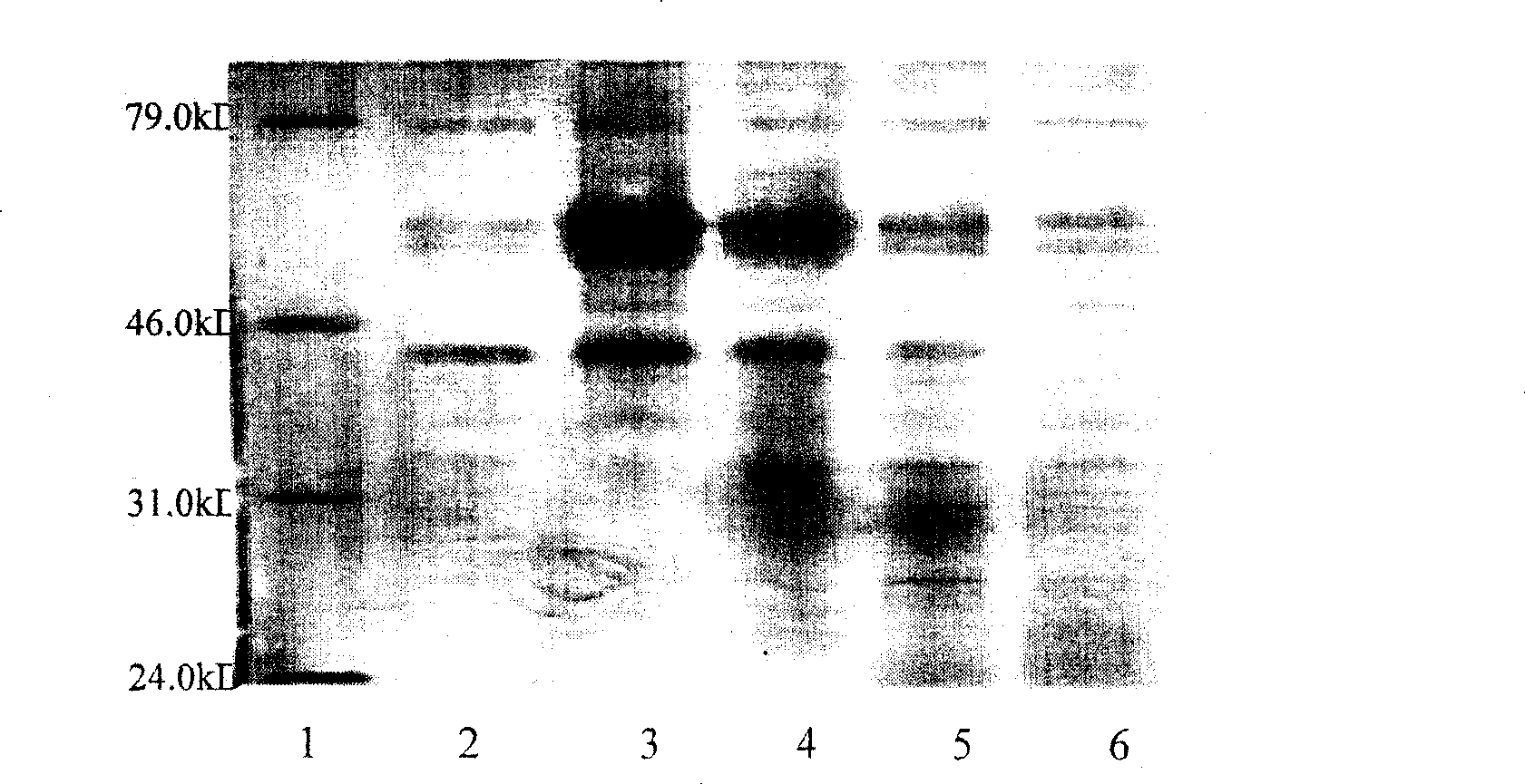 Human tissue factor pathway inhibitory factor mutation gene m0TFPI, recombination carrier and recombination microzyme including the same