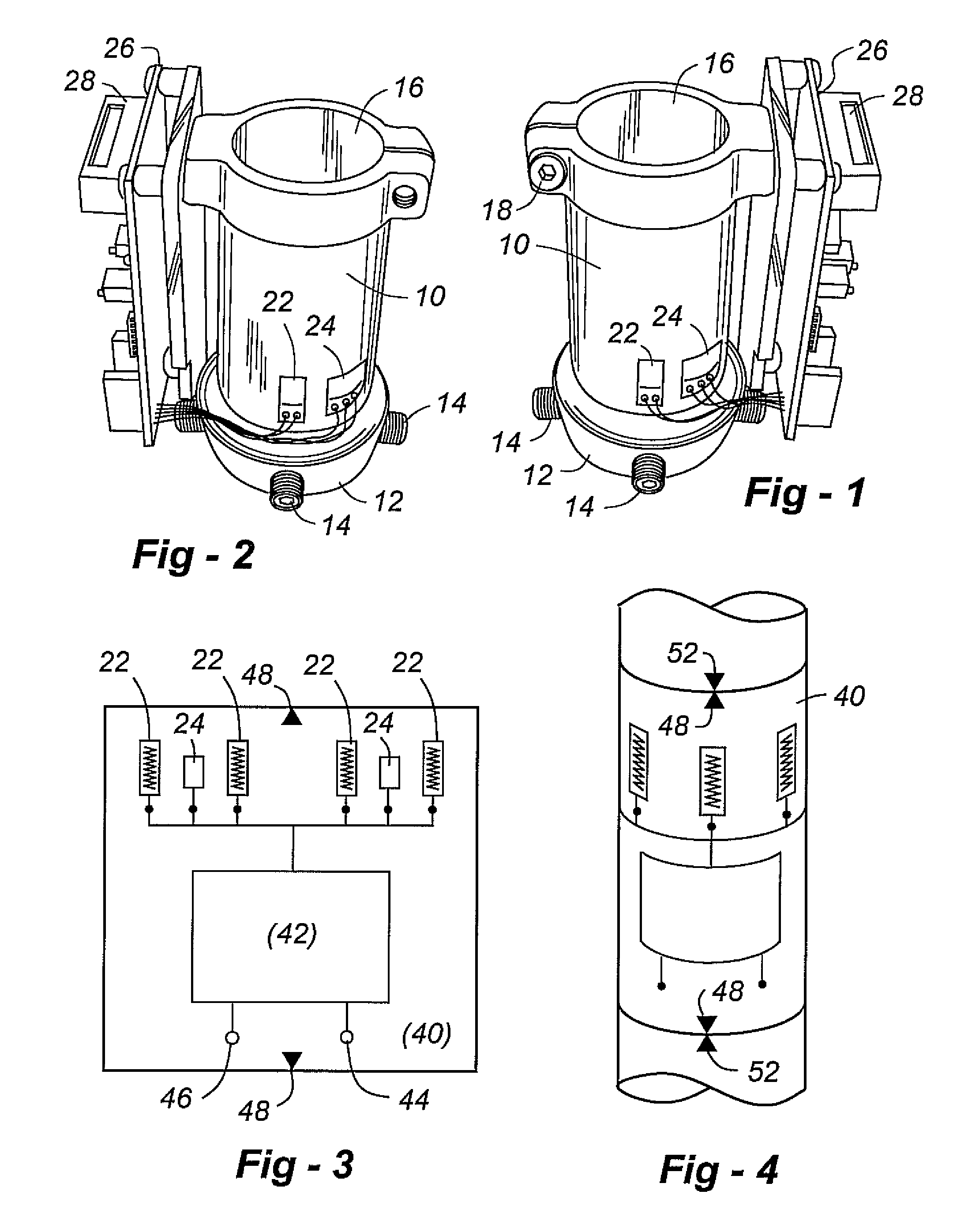 Prosthetic sensing systems and methods
