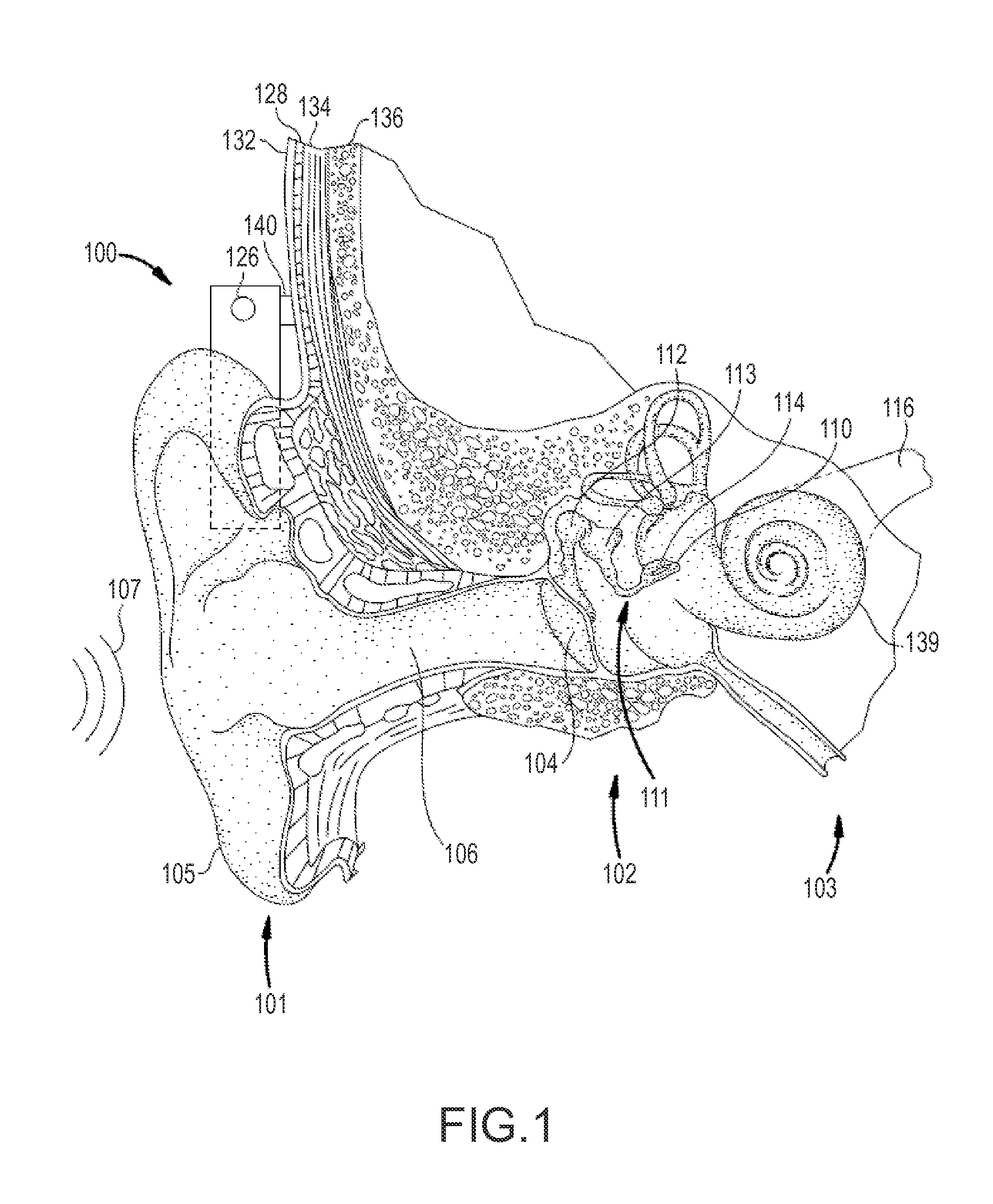 Medical device diagnostics using a portable device