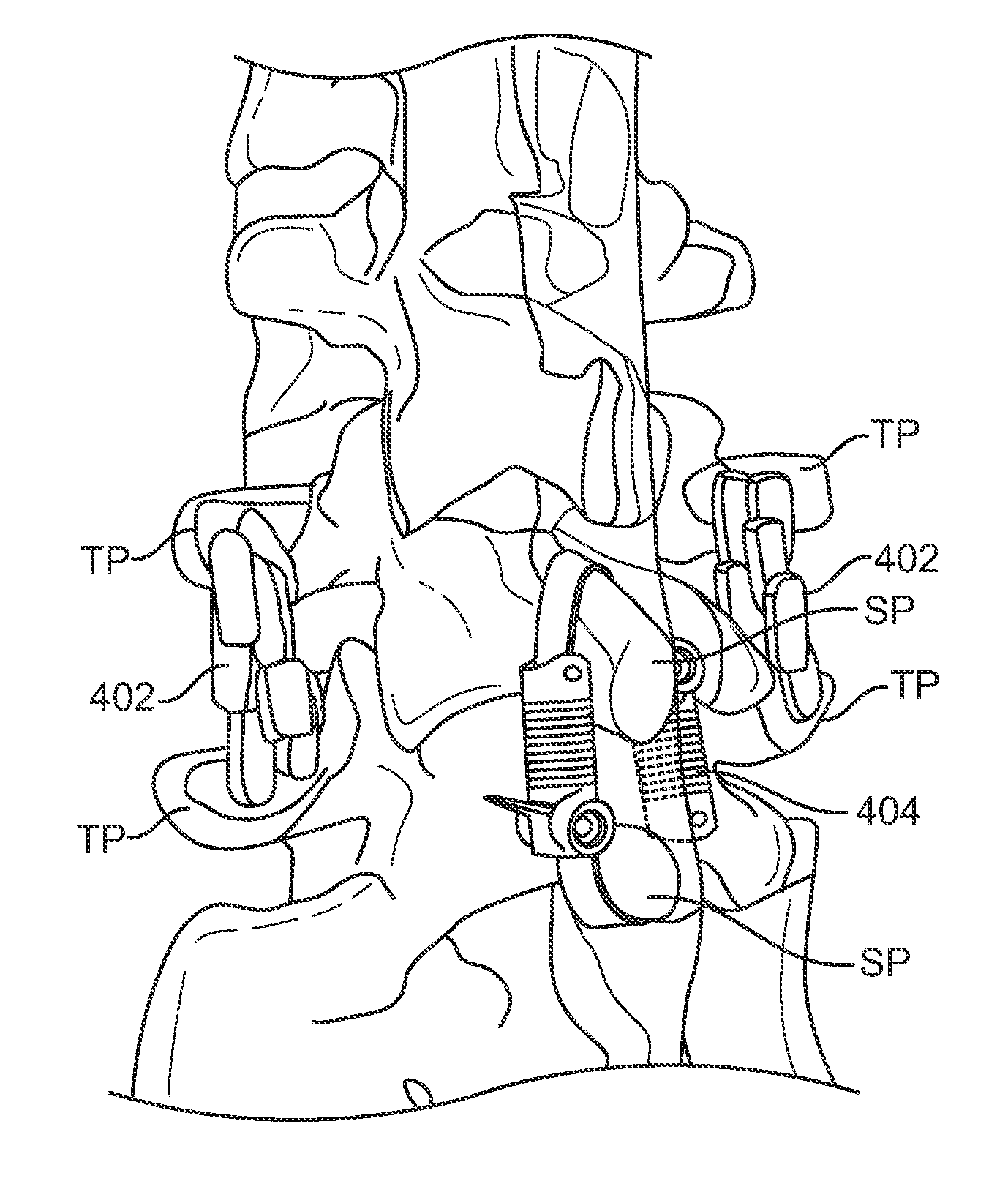 Surgical tether apparatus and methods of use