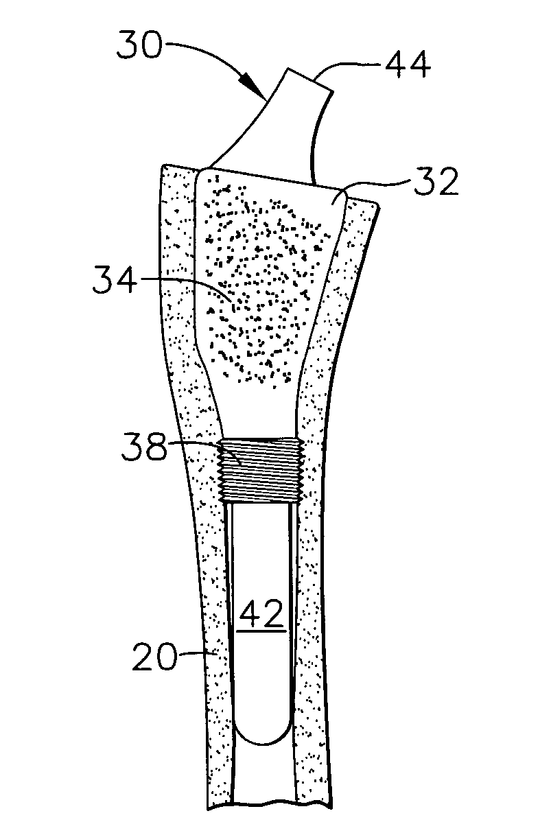 Bone cell covered arthroplasty devices