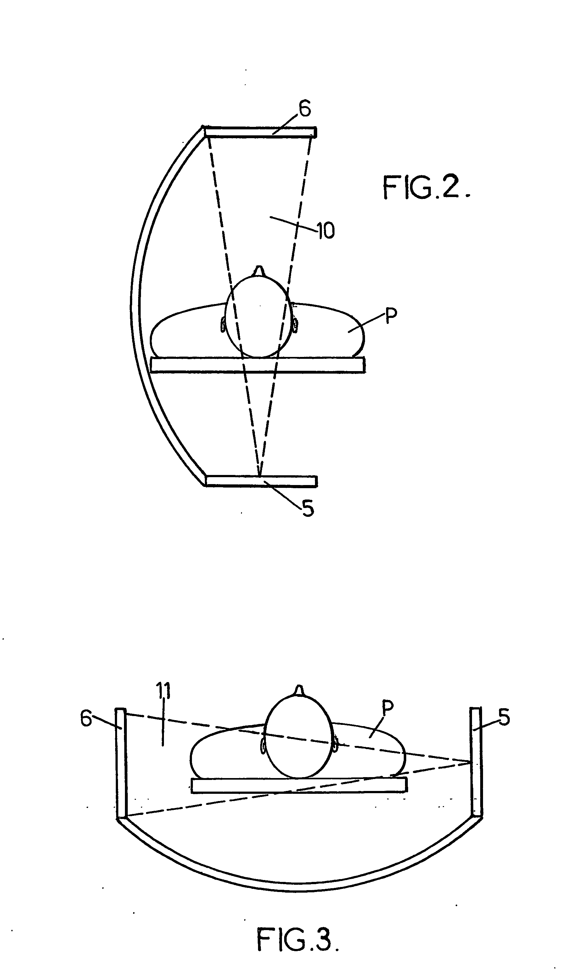 Method and device for radiographic imaging