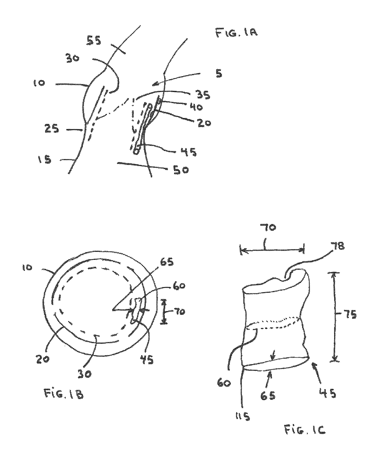 Perivalvular occlusion device and methods