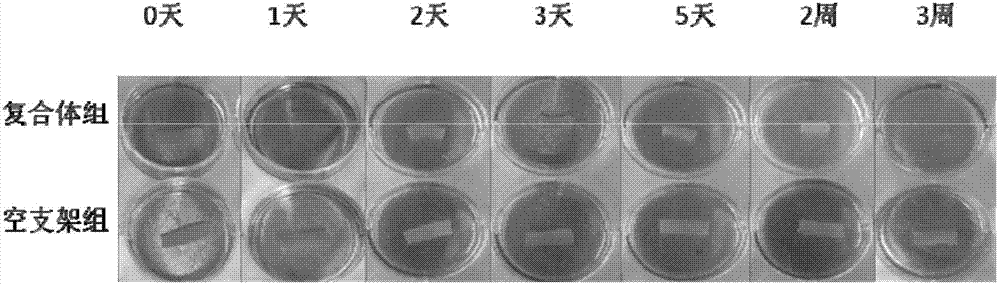 Application of basic fibroblast growth factor to improvement of tissue engineered heart conduction bundle deformation