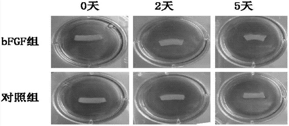 Application of basic fibroblast growth factor to improvement of tissue engineered heart conduction bundle deformation