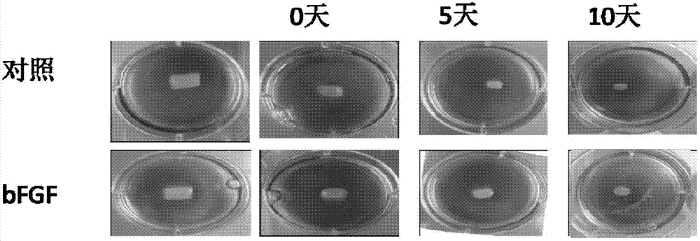 Application of basic fibroblast growth factor to improvement of tissue engineered heart conduction bundle deformation