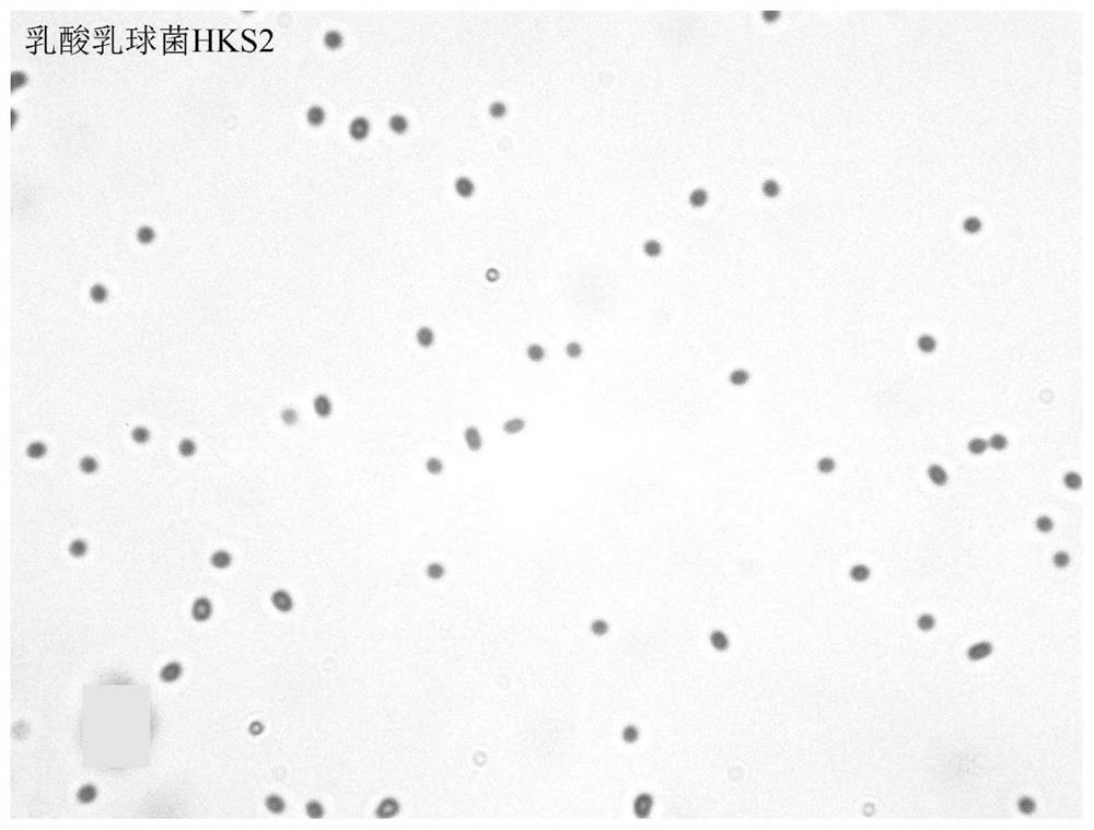 A kind of Lactococcus lactis hks2 with lactic acid activity and its isolation and screening method and application
