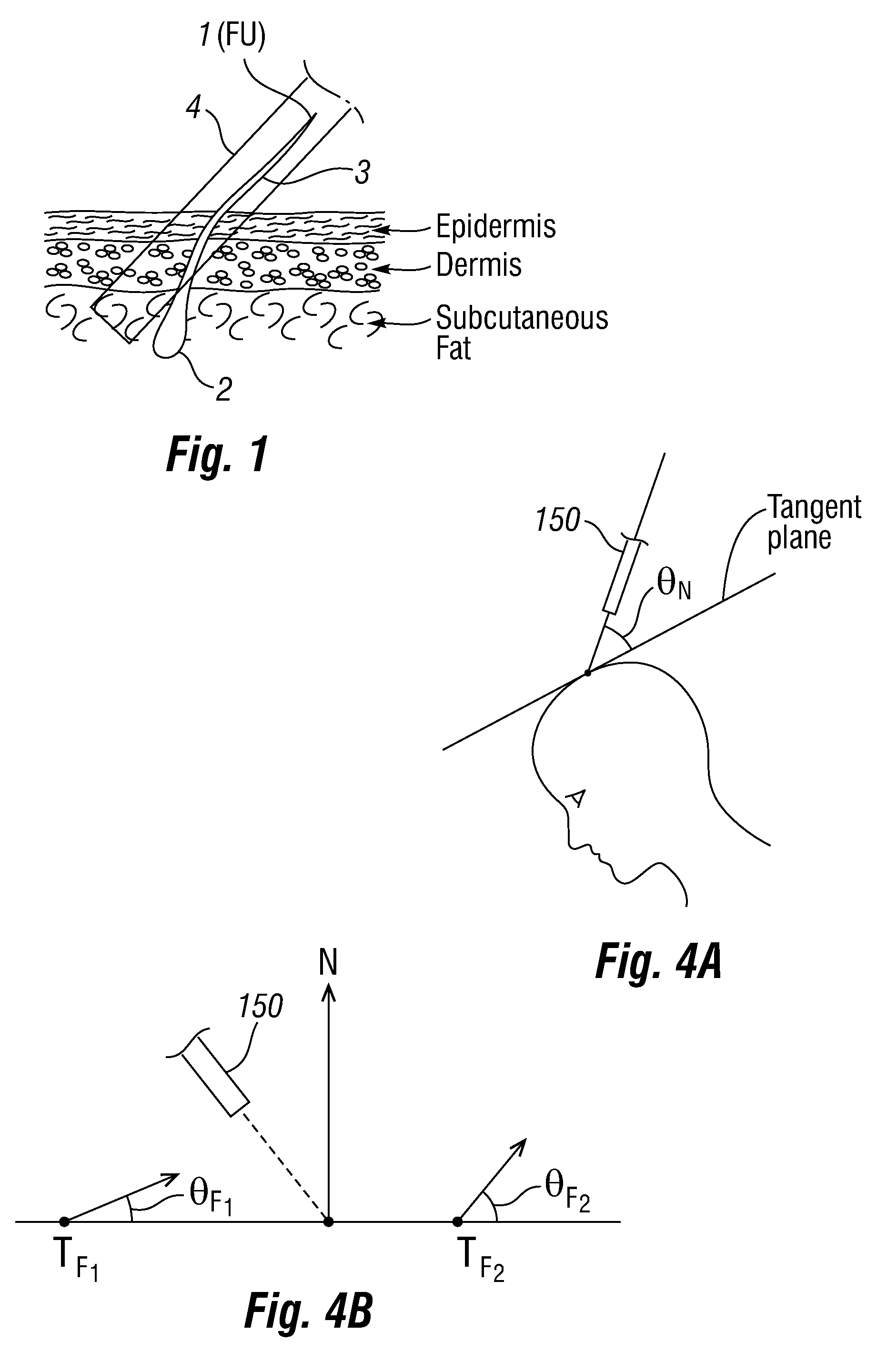 System and method for harvesting and implanting hair using image-generated topological skin models