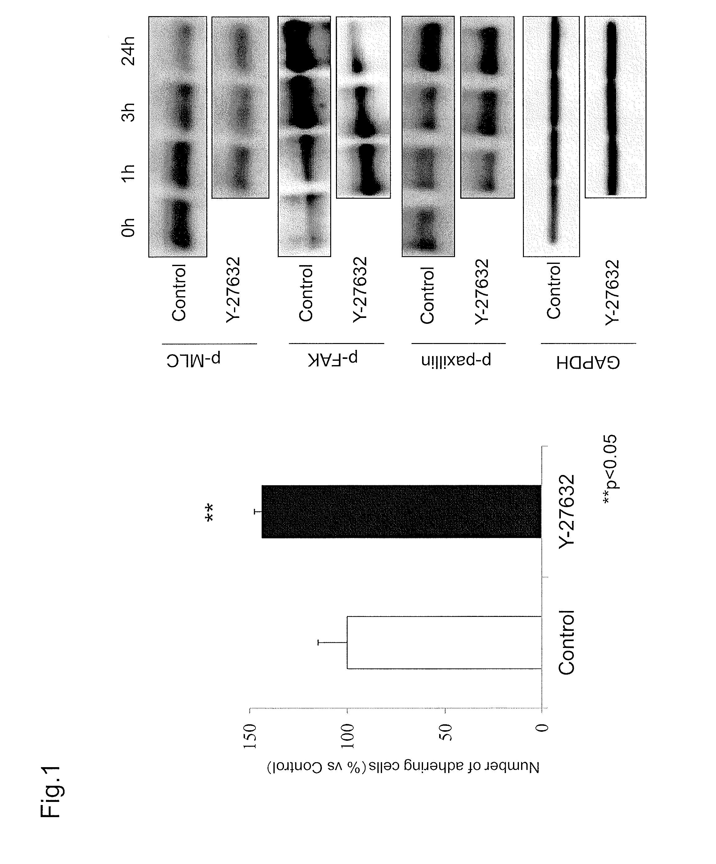 Combined agent for cell therapy of corneal endothelial cell