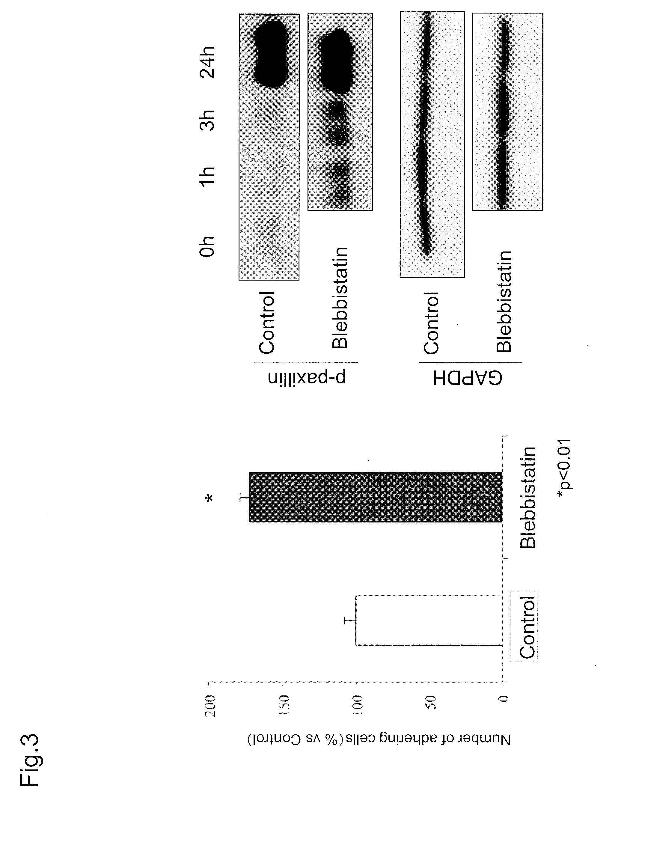 Combined agent for cell therapy of corneal endothelial cell