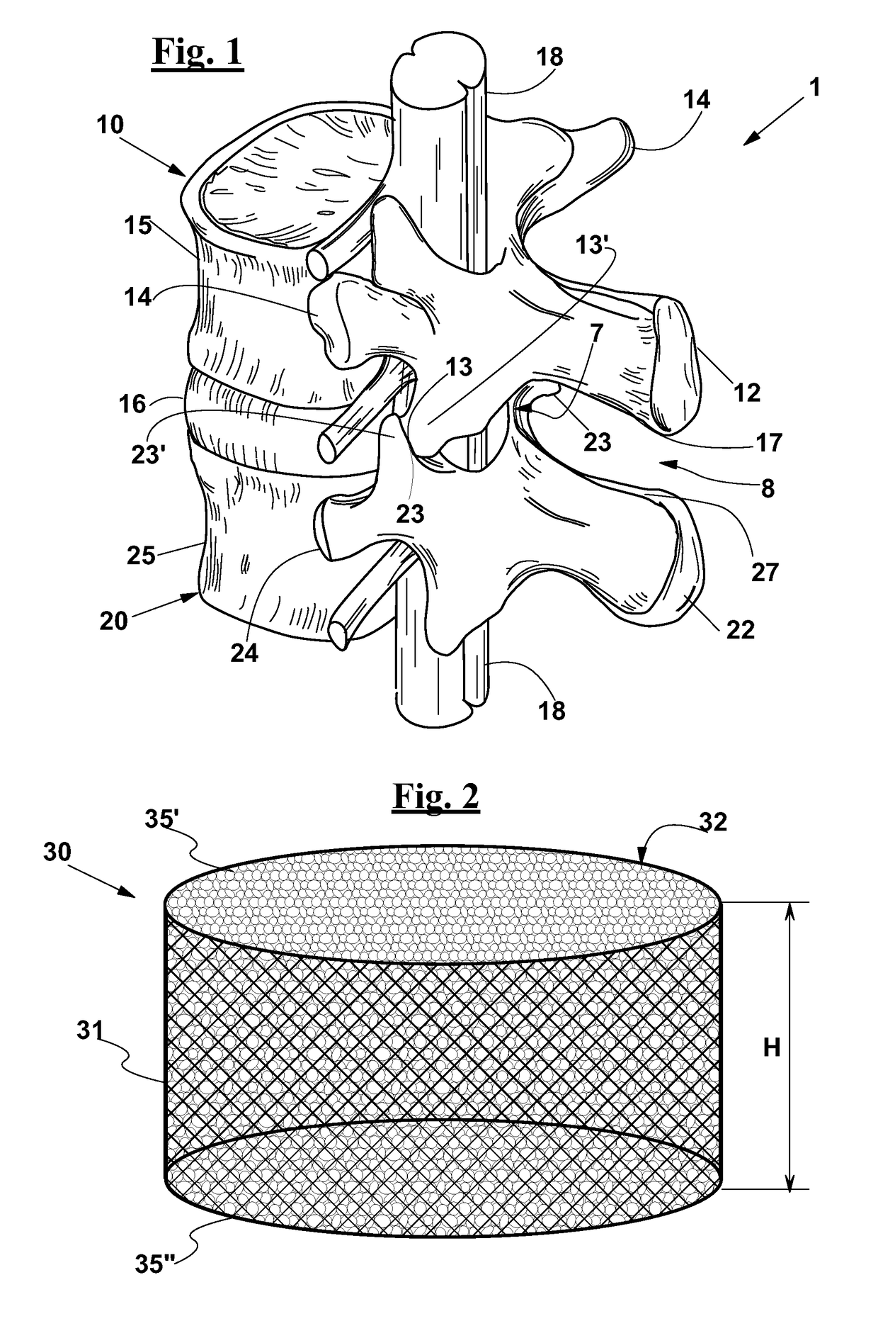 Vertebral fusion device and system