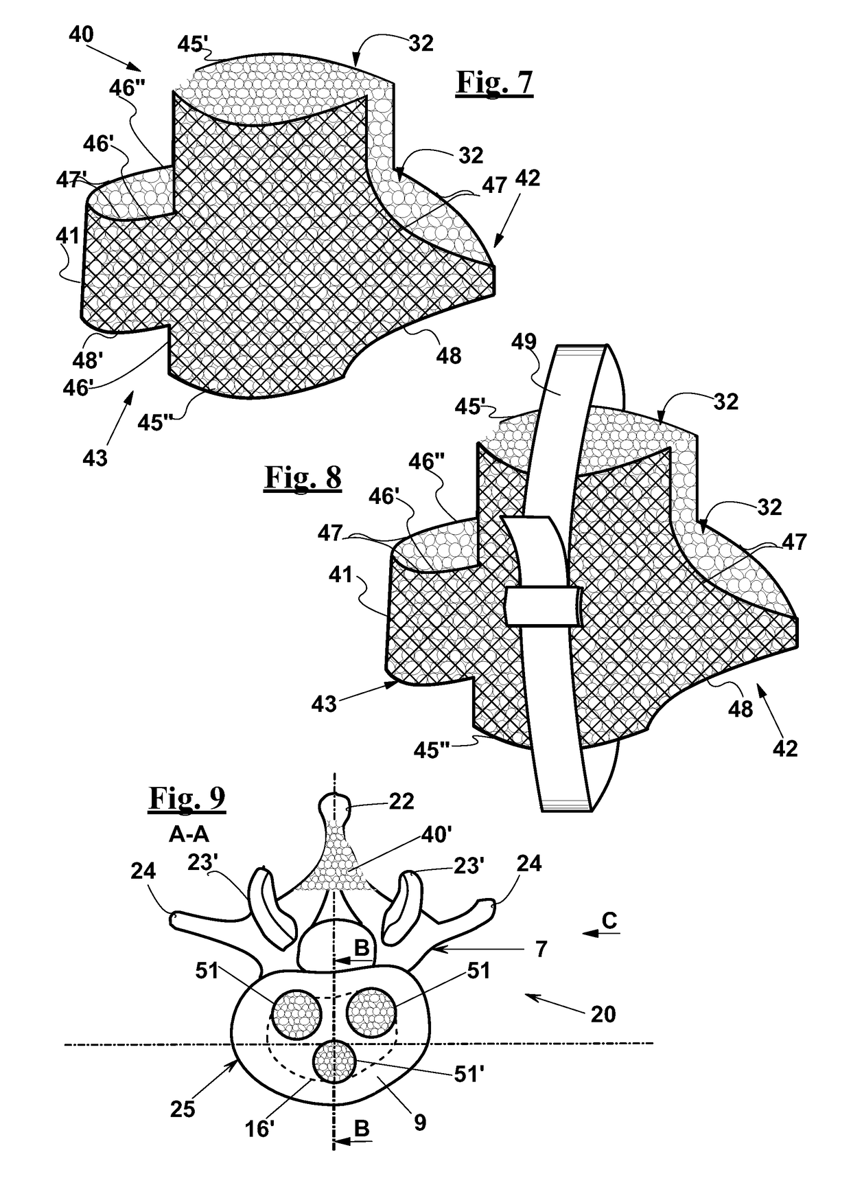 Vertebral fusion device and system