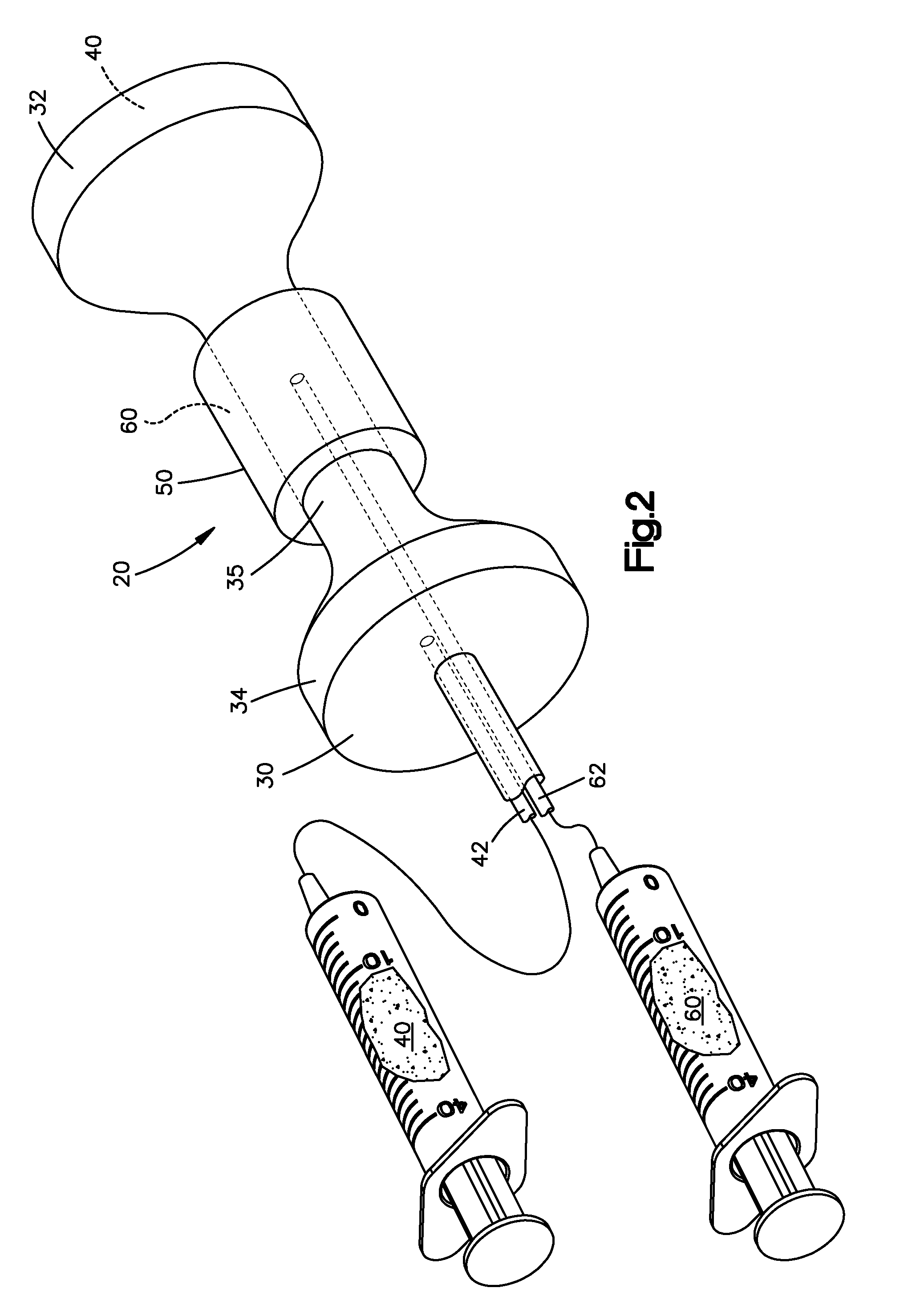 Inflatable interspinous spacer