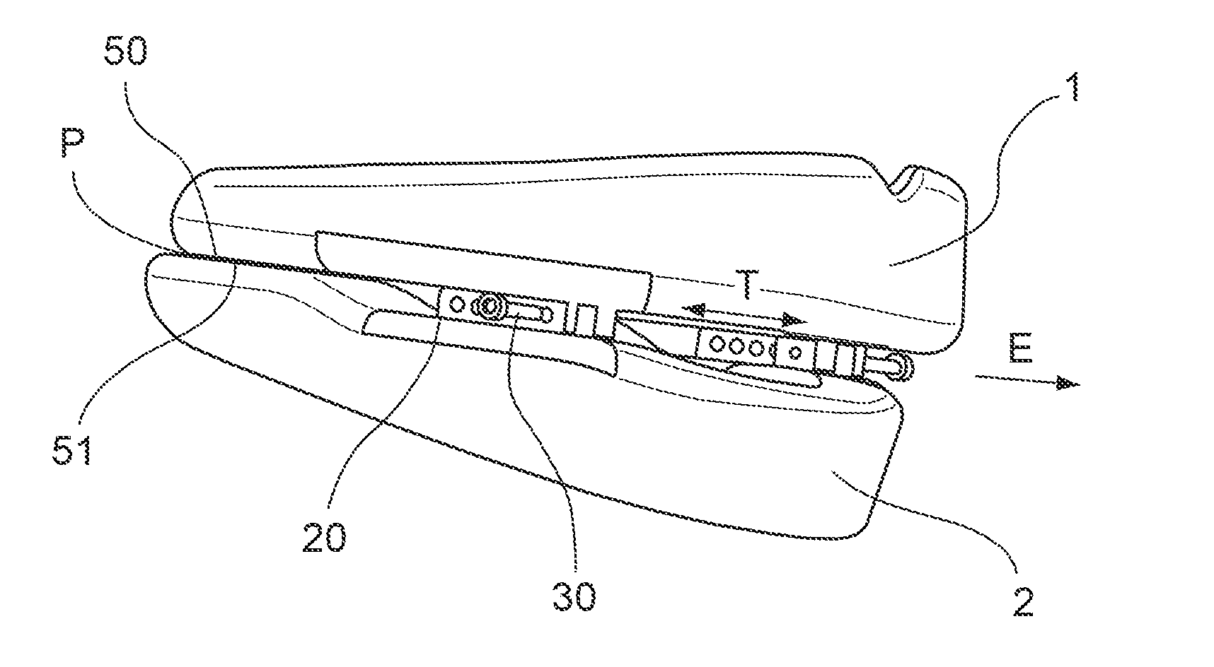 Orthosis comprising an upper tray and a lower tray, and connection with adjustable positioning