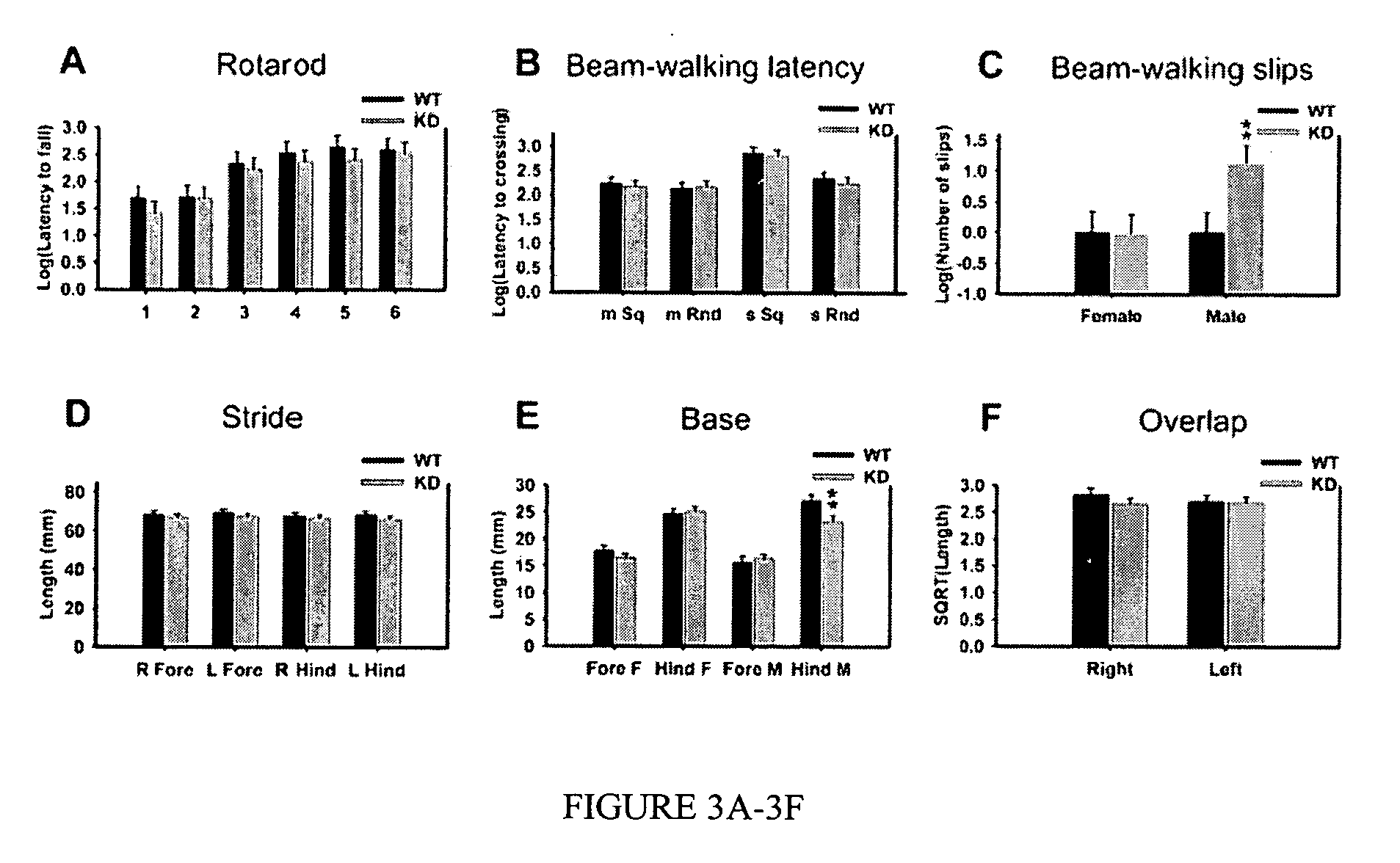 Methods and compositions for the treatment of dystonia