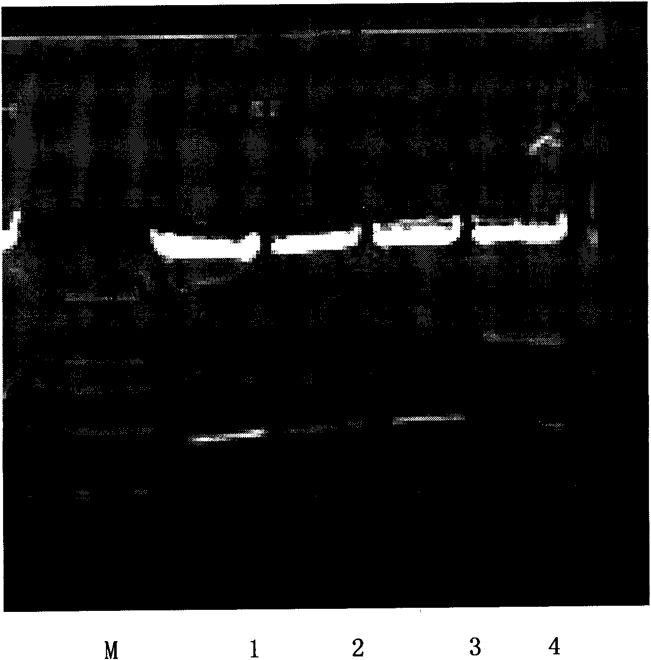 Fusion protein of human epidermal growth factor and metallothionein and preparation method and application thereof