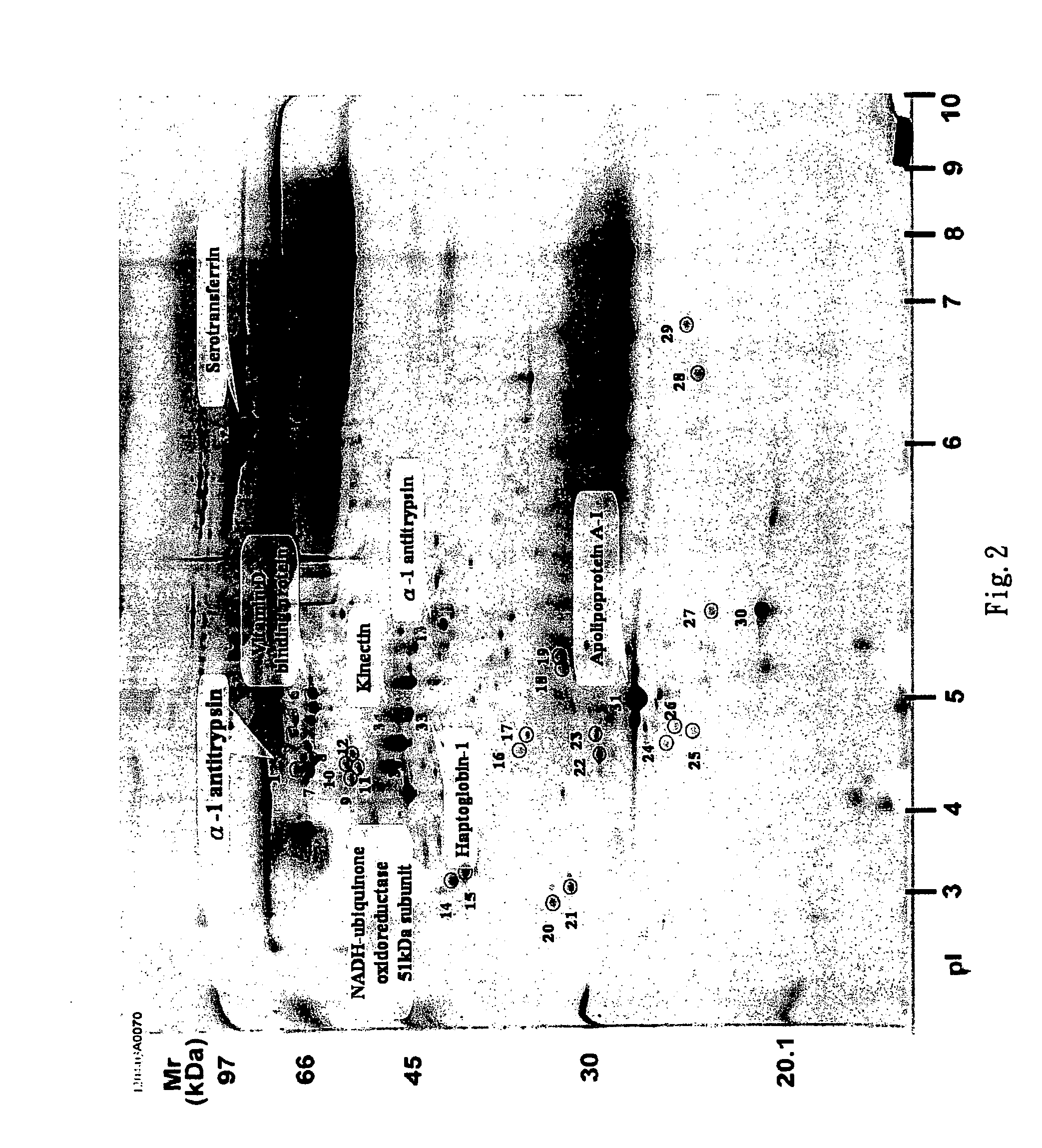 Diagnosis method of endometriosis by detecting biochemical markers and usage of these biochemical markers